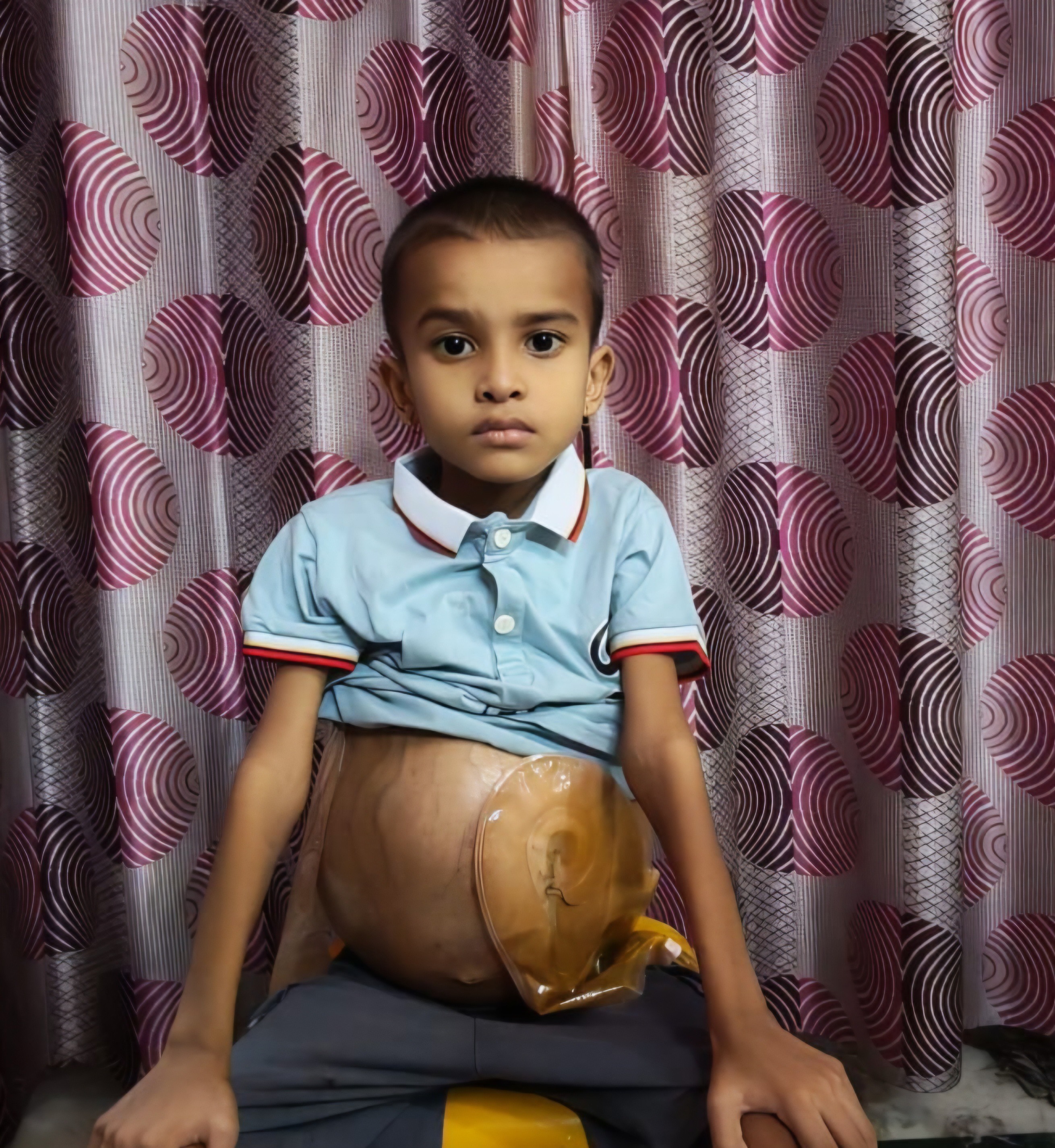 Help 6-Year-Old Prajwal Fight Cancer campaign photo, 5 of 8