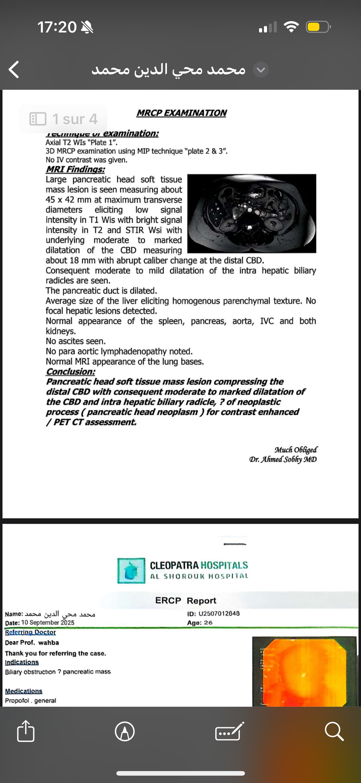 Urgent : Cancer operation Egypt campaign photo, 4 of 6