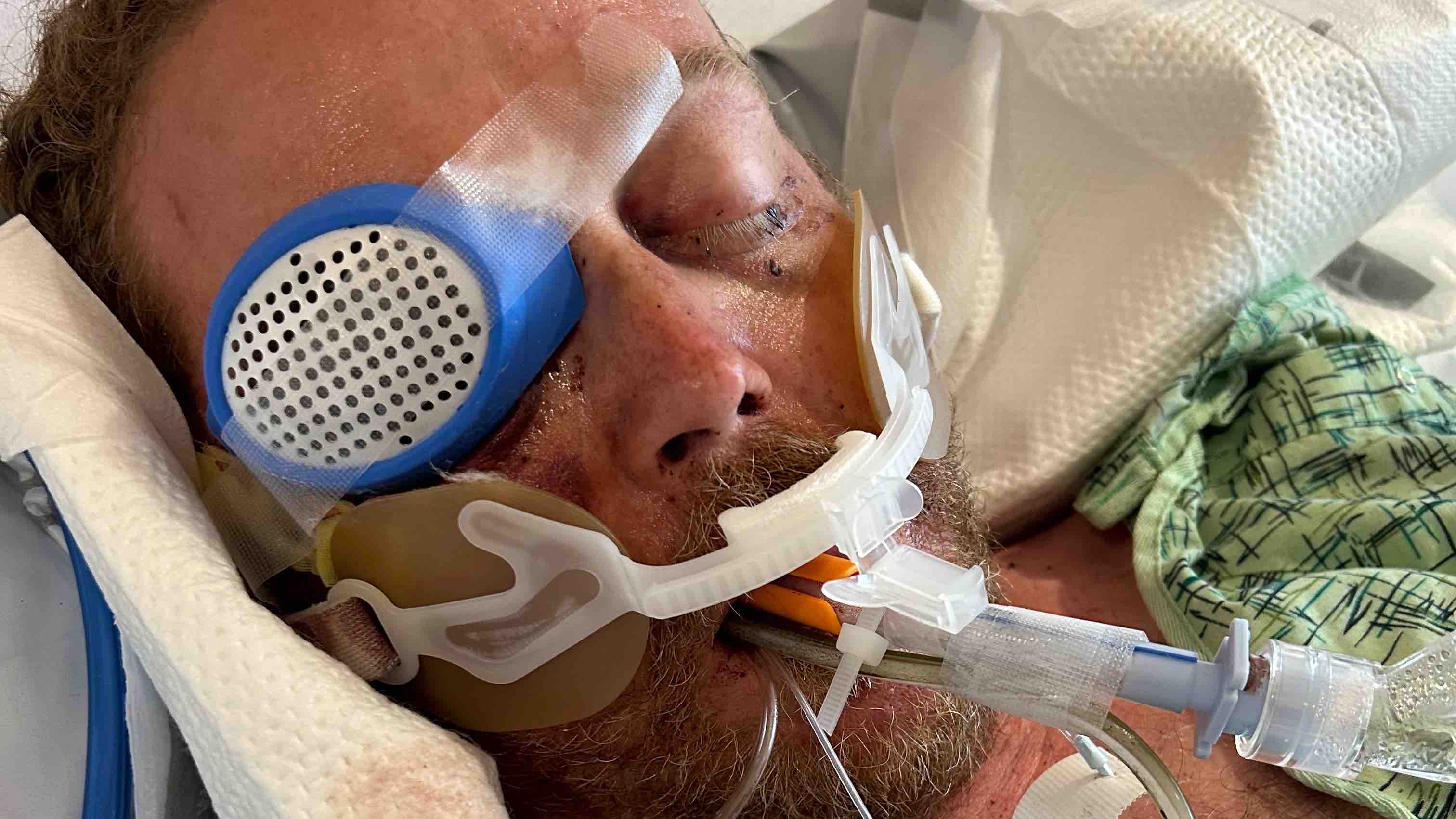 Support Joey's Recovery from Spinal Injury photo