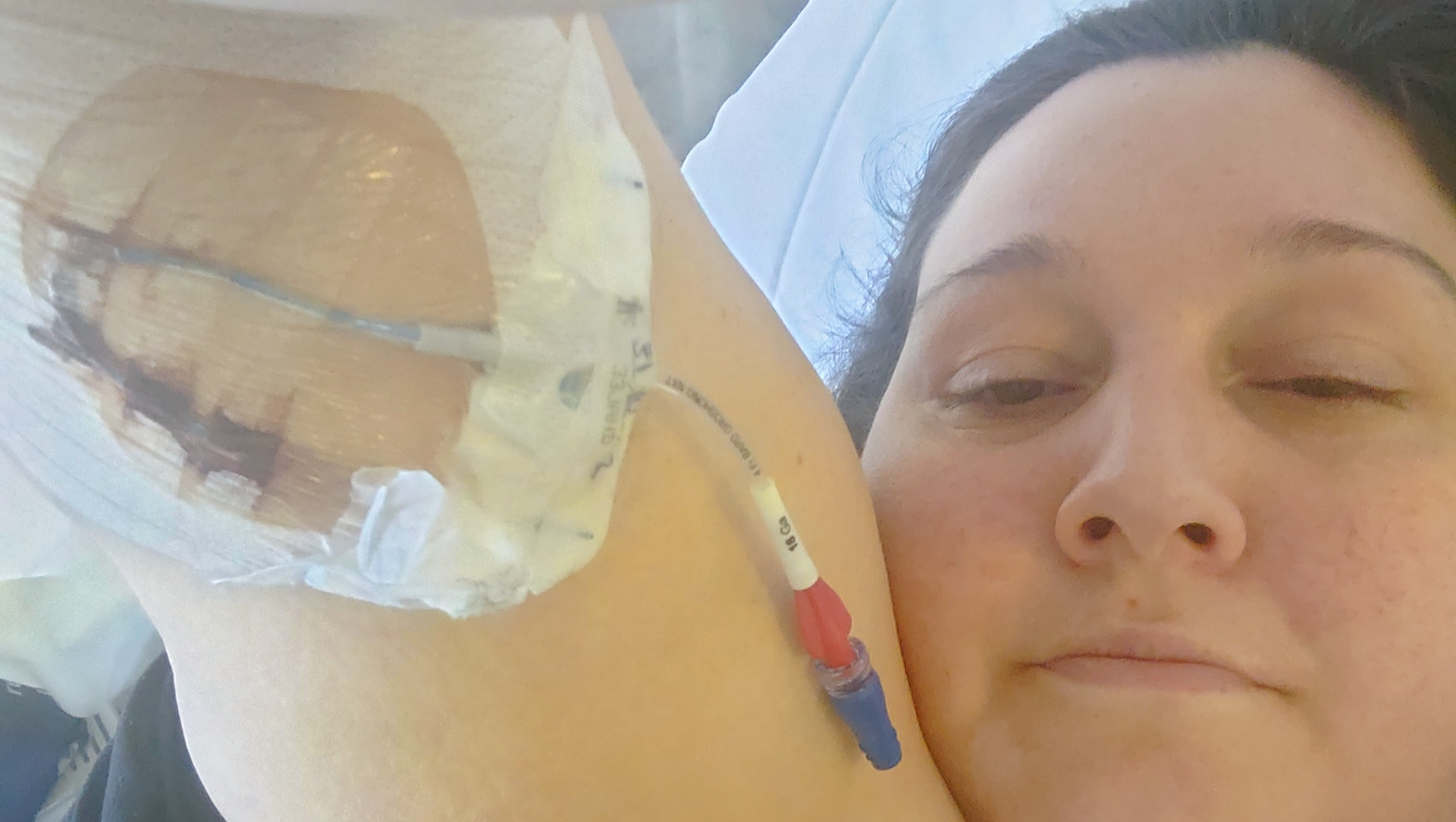 Help a Mum Get the Surgery the NHS Won’t Provide”