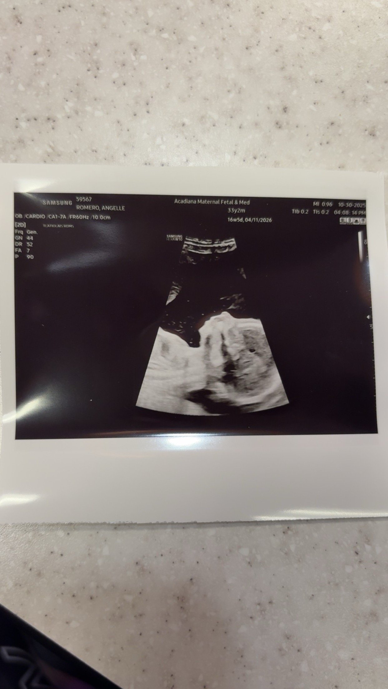 Single Pregnant Mama with TRAP Syndrome needs help. campaign photo, 2 of 6