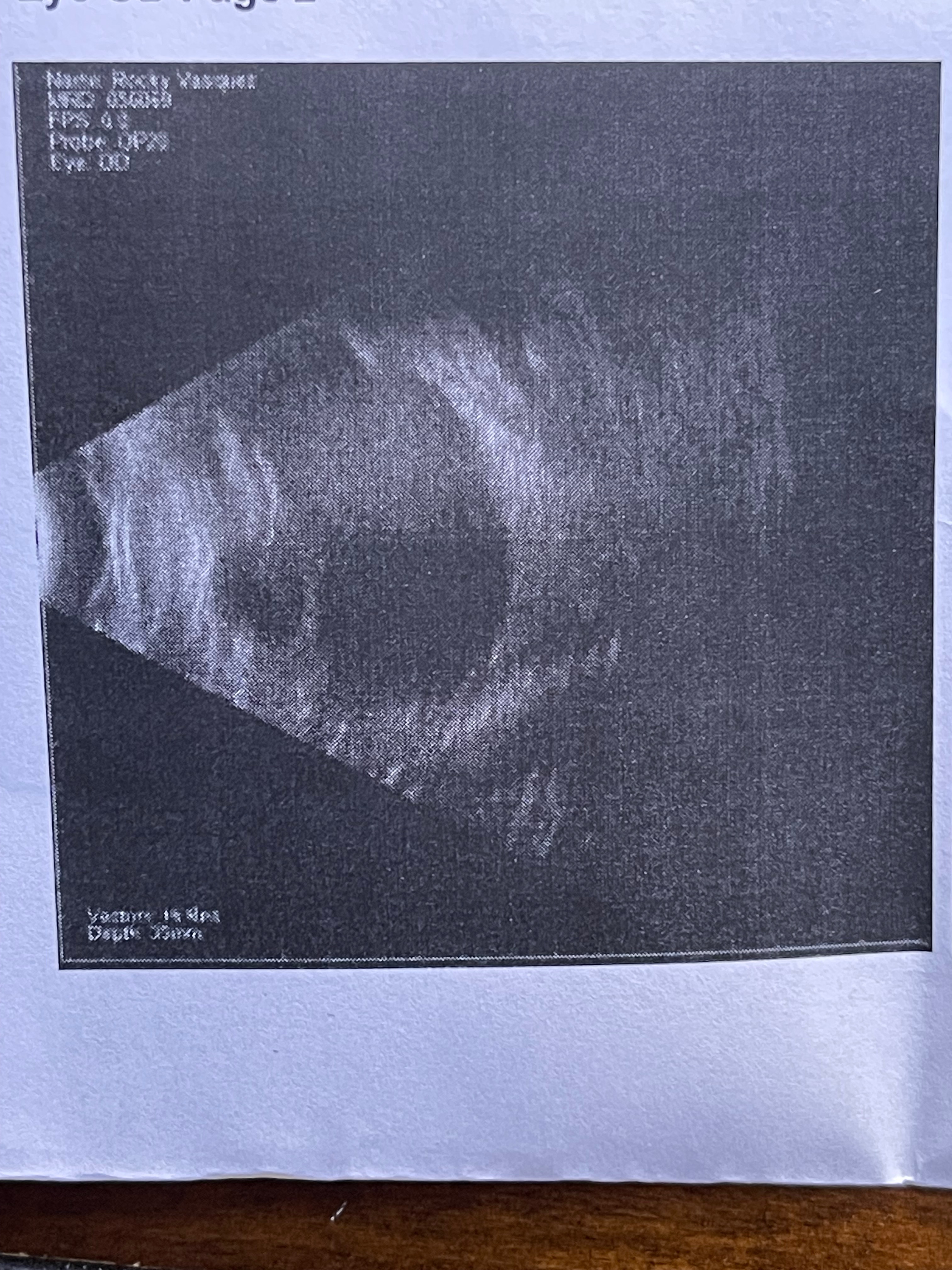 Help Rocky’s Eye removal surgery campaign photo, 4 of 8