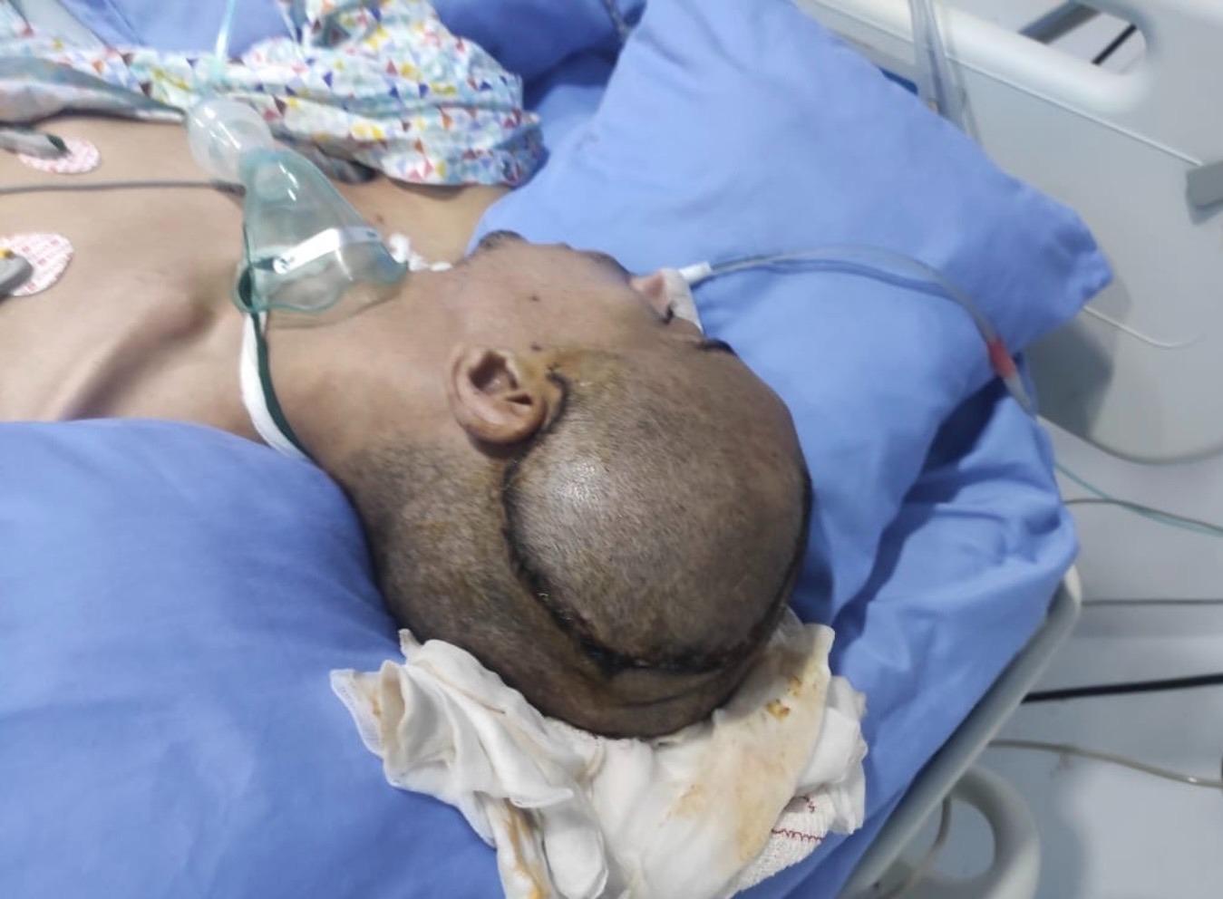 Help Save Oussamas Life – Emergency Brain Surgery in Morocco campaign photo, 4 of 7