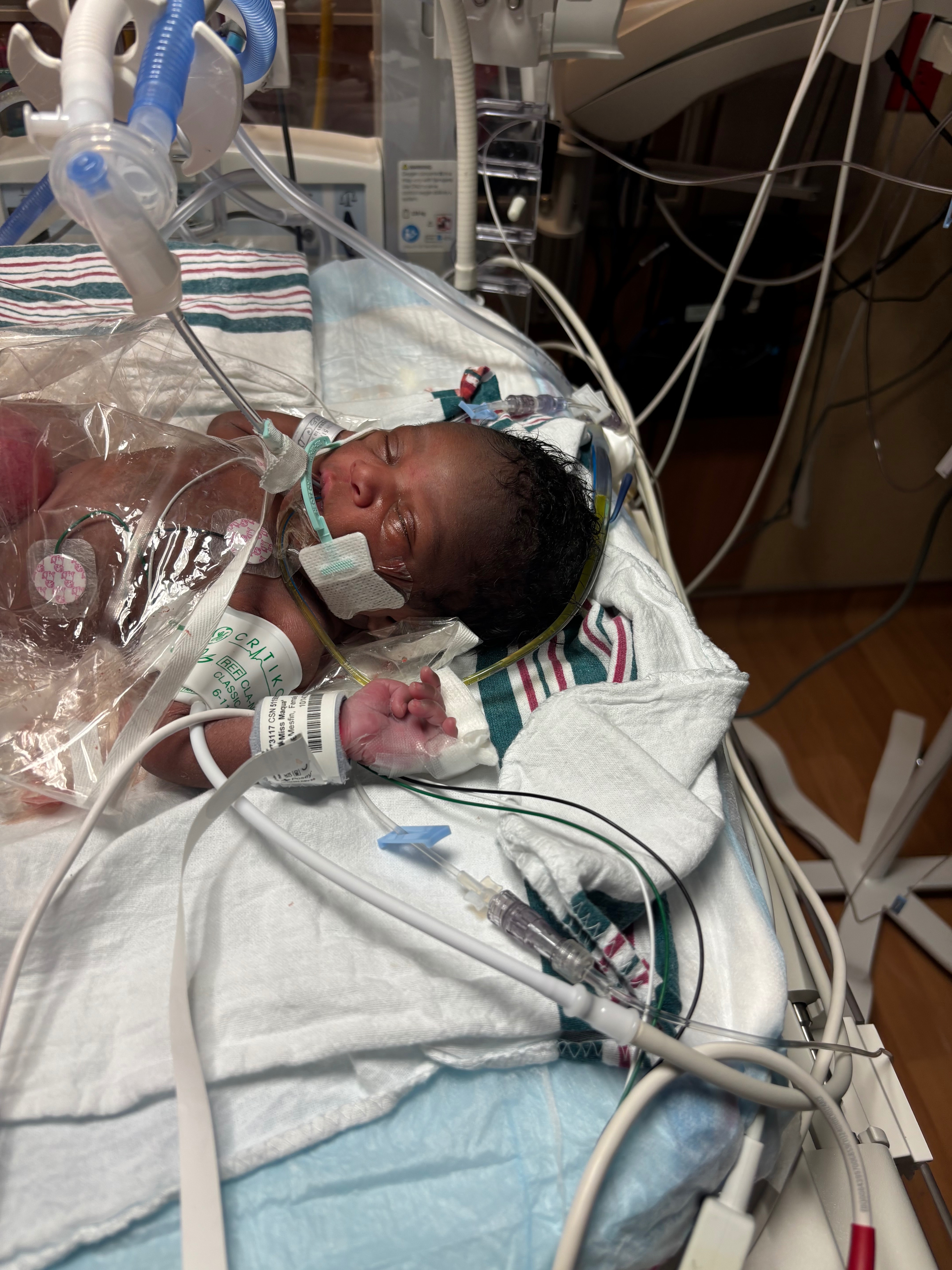 Support Miór Miracle Dumercy's Healing Journey campaign photo, 7 of 8