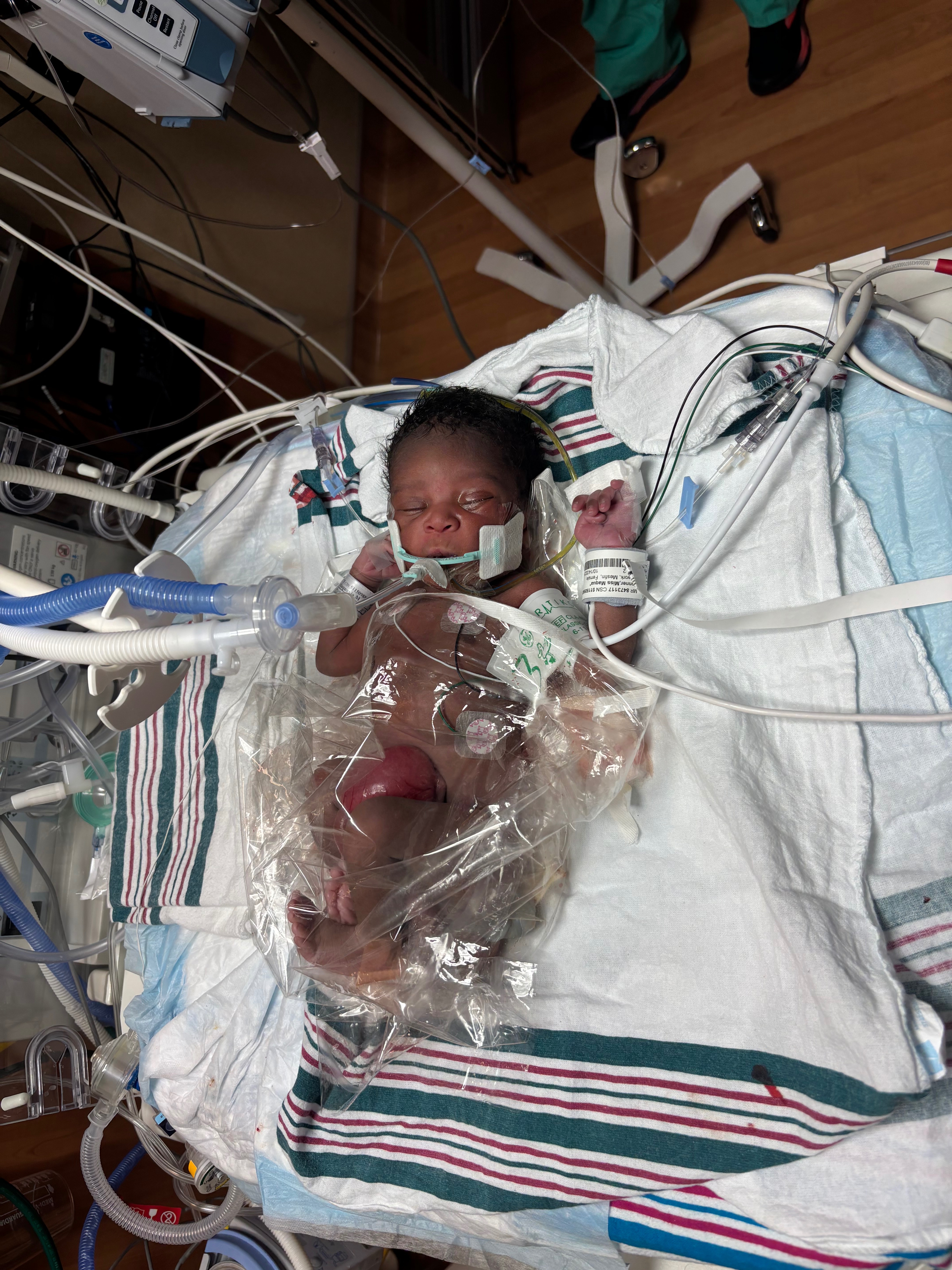 Support Miór Miracle Dumercy's Healing Journey campaign photo, 6 of 8
