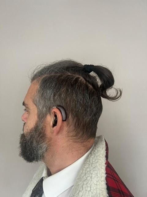 Steve's big shave and bleach! campaign photo, 2 of 6