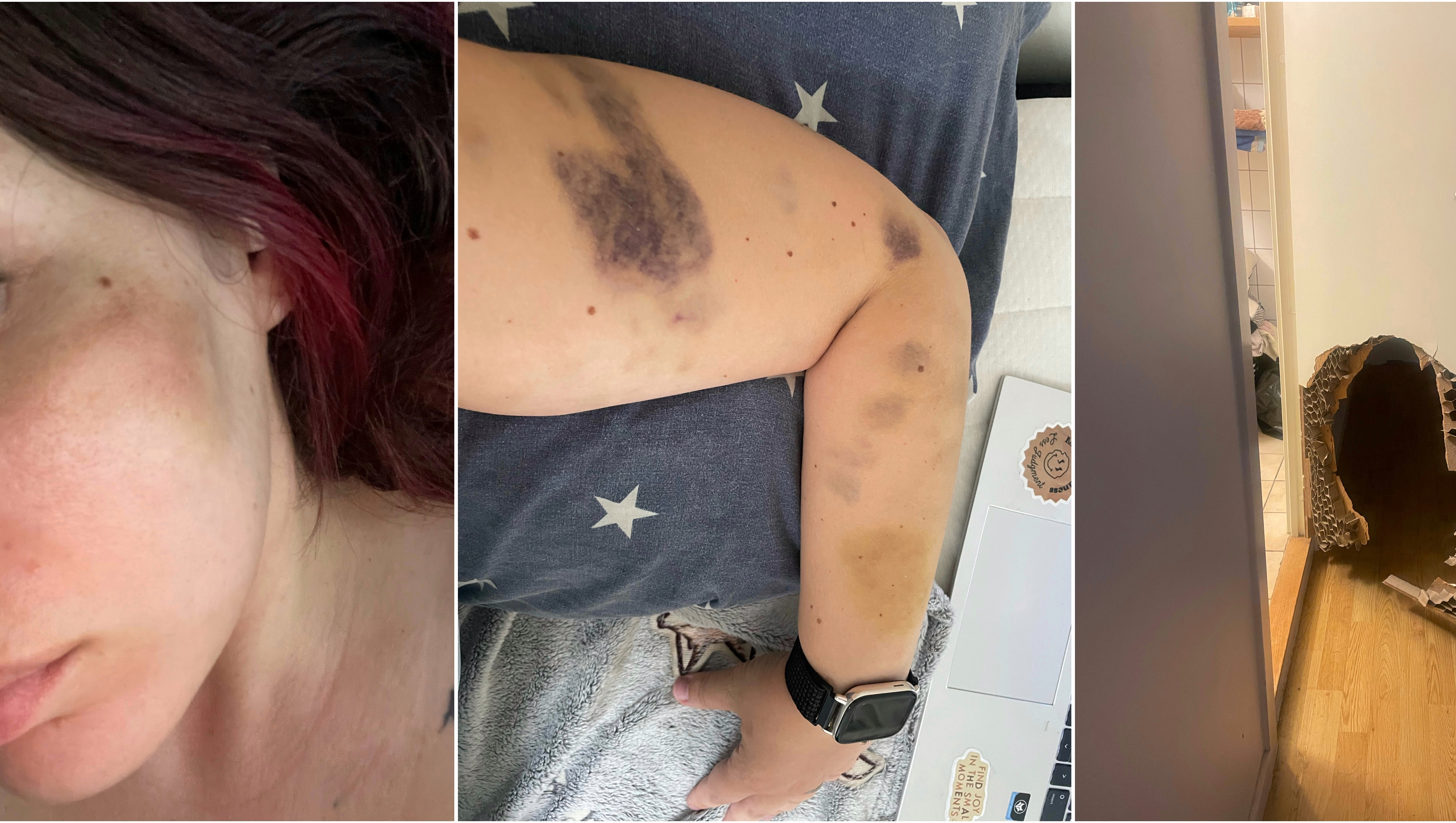 Help me start over after abuse photo