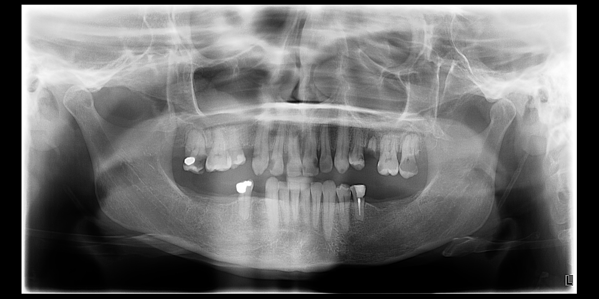 Help Jennifer Restore Her Smile and Health campaign photo, 4 of 4