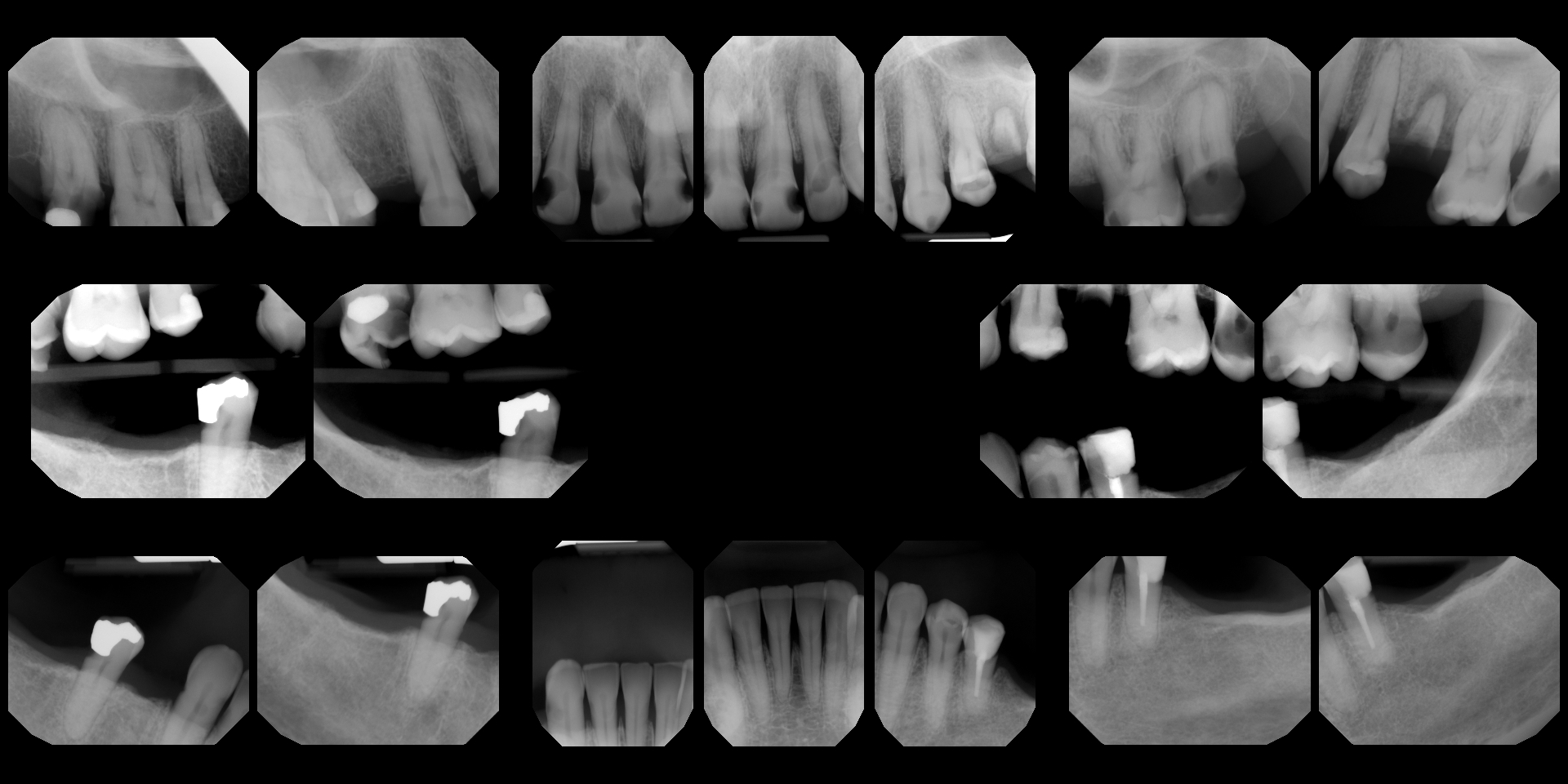 Help Jennifer Restore Her Smile and Health campaign photo, 2 of 4