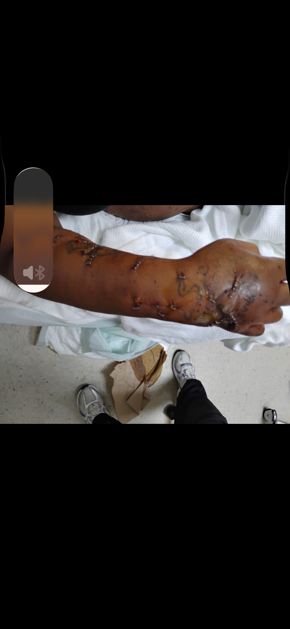 Help Mariah Campbell Recover from Dog Attack campaign photo, 2 of 7