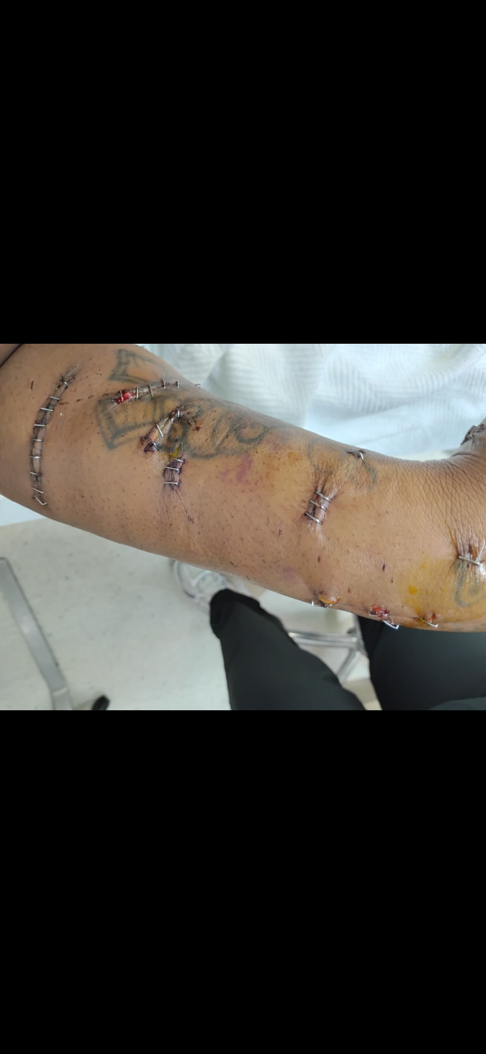 Help Mariah Campbell Recover from Dog Attack campaign photo, 4 of 7