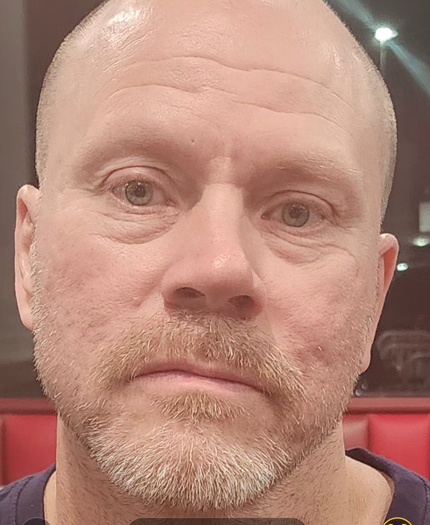 Donate to Aid Husband's Long Recovery campaign photo, 2 of 4