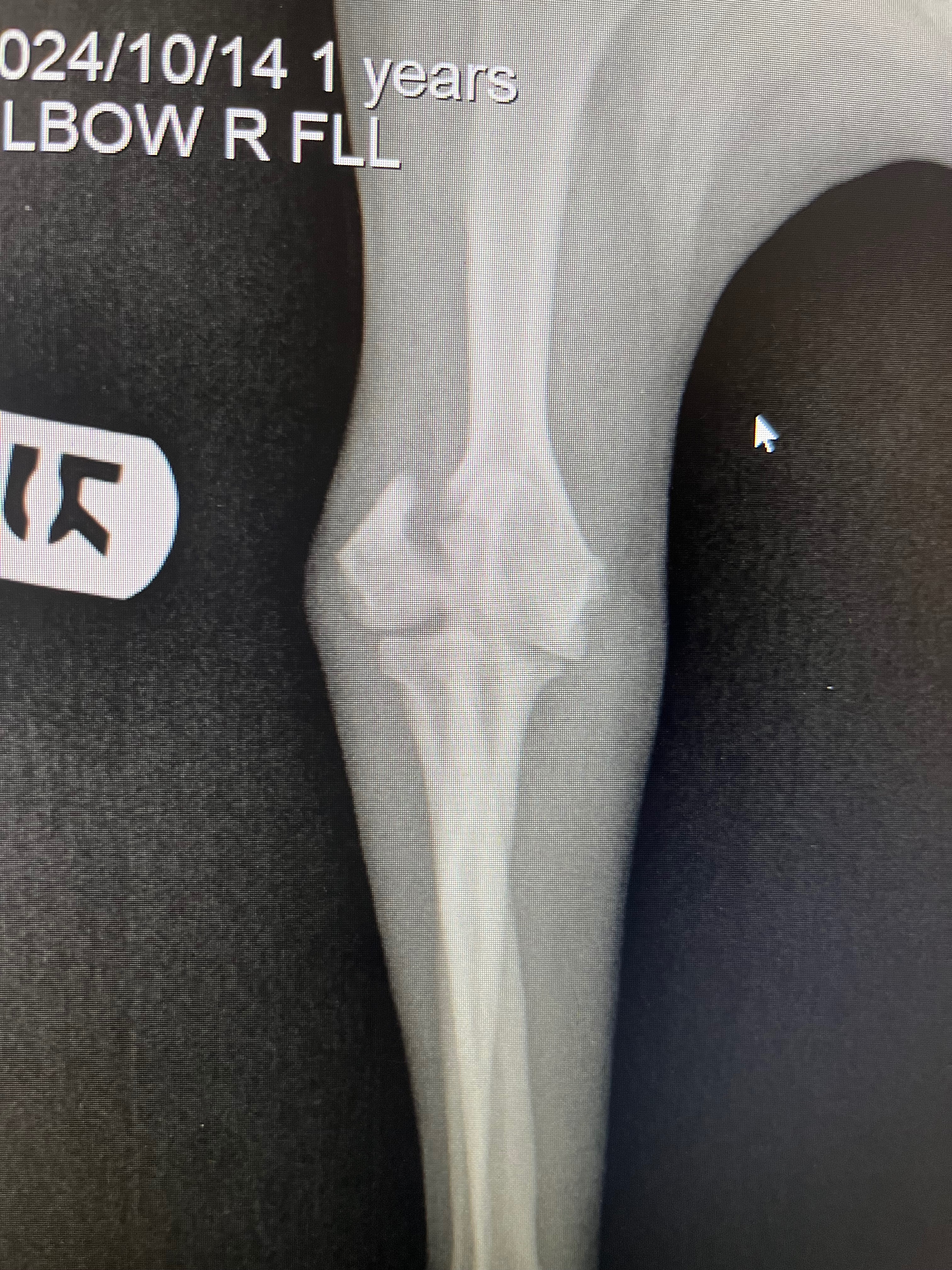 Please help Bella- surgery needed to use her leg again campaign photo, 5 of 8