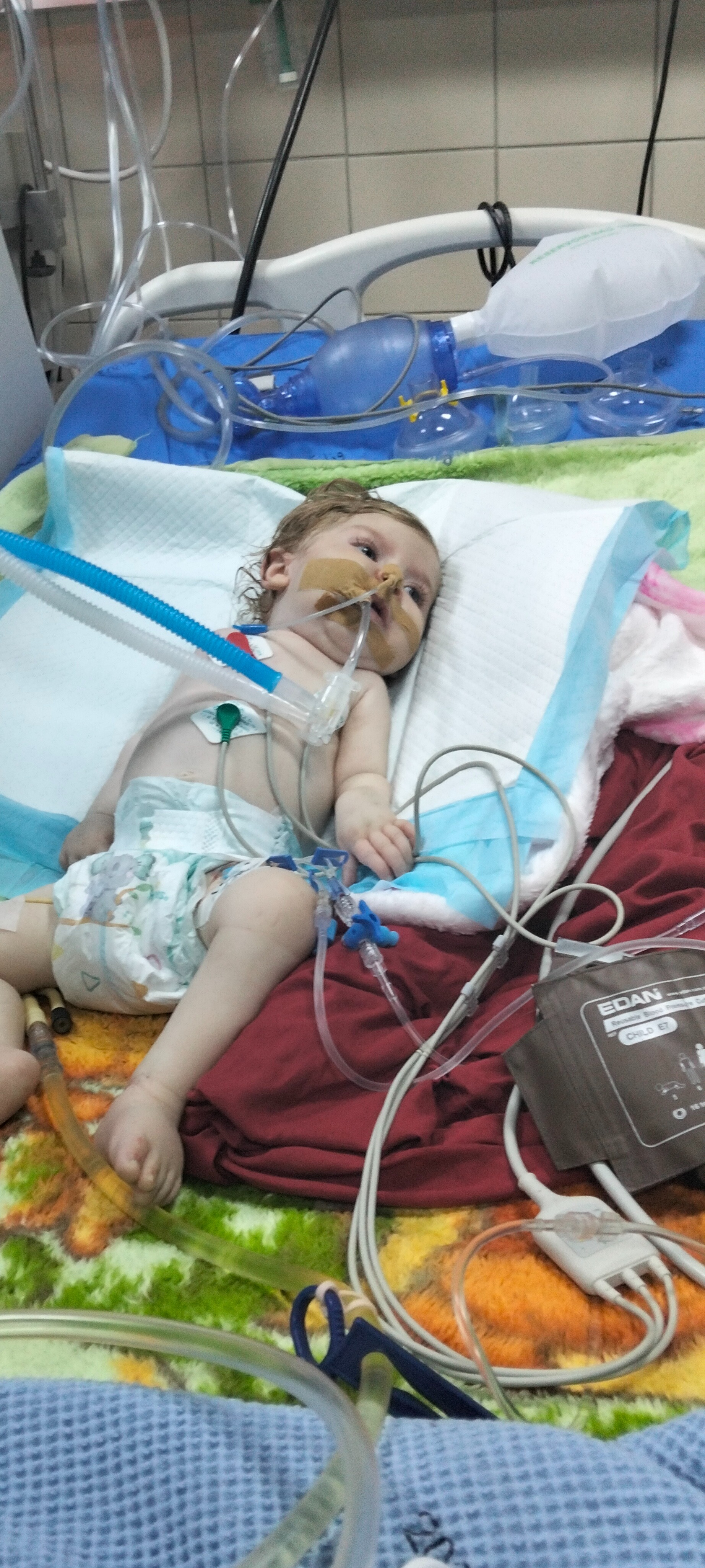 The child Basmalah Fighting an illness SMA type 1 campaign photo, 5 of 6