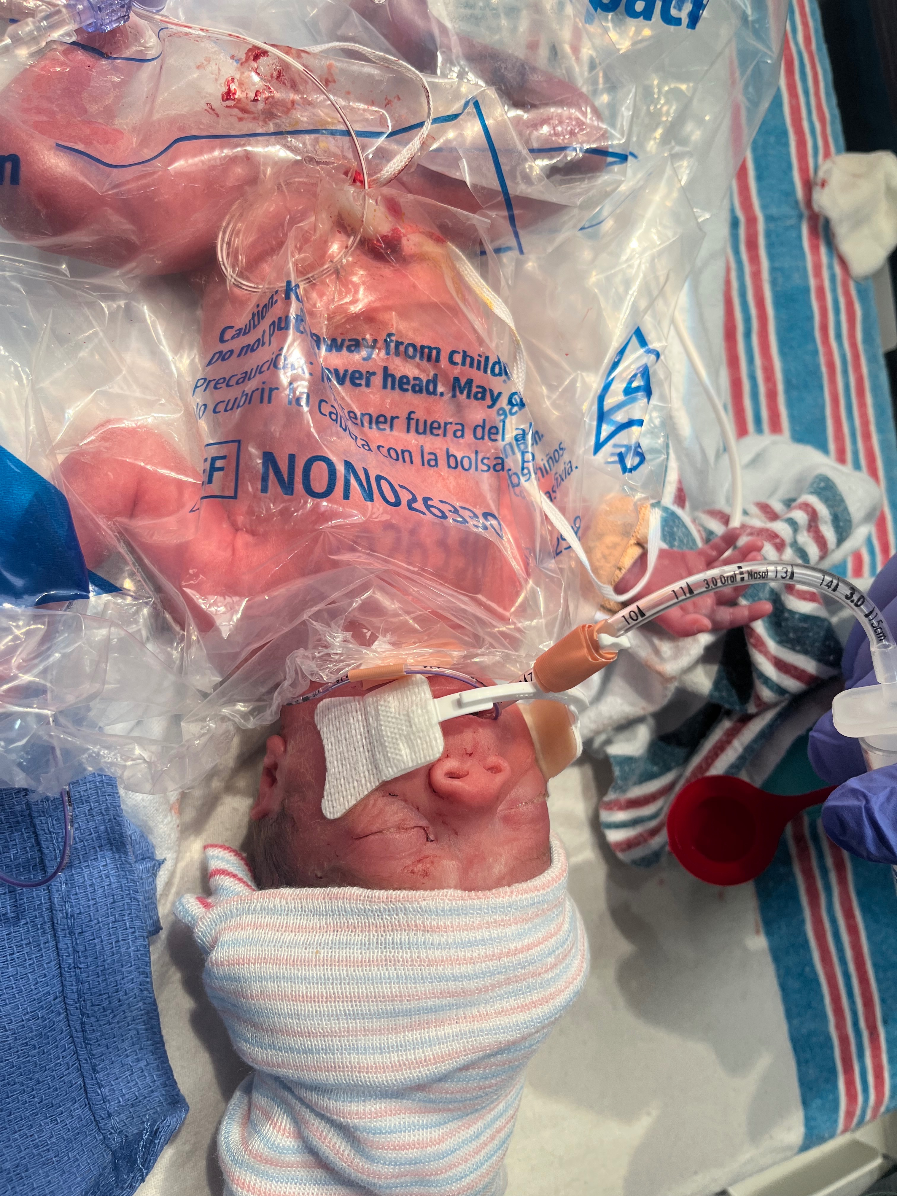 Support Shelby and Lei’Cora's NICU Journey campaign photo, 2 of 8