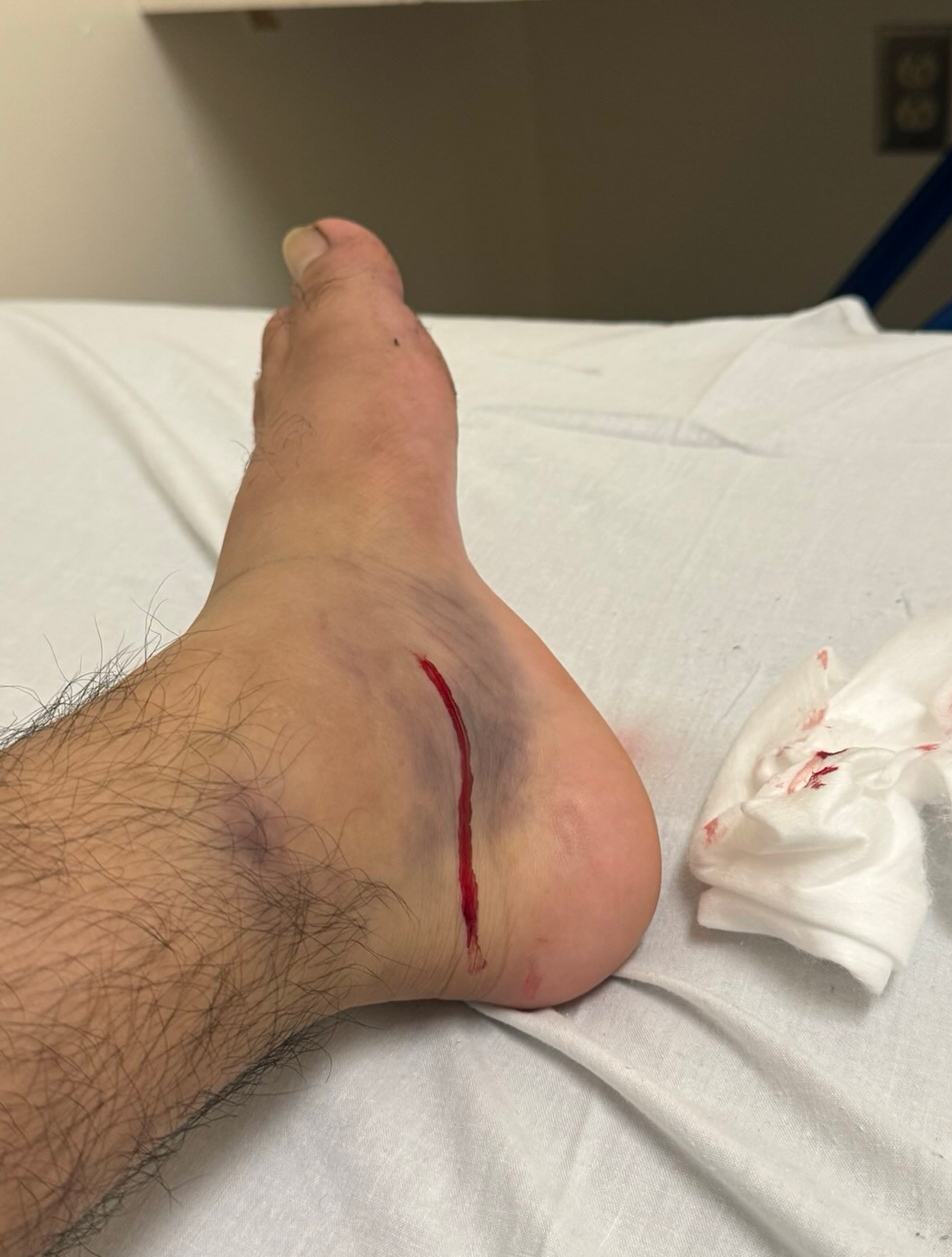 Support Day Laborer Injured During Penske I.C.E. Raid campaign photo, 2 of 6