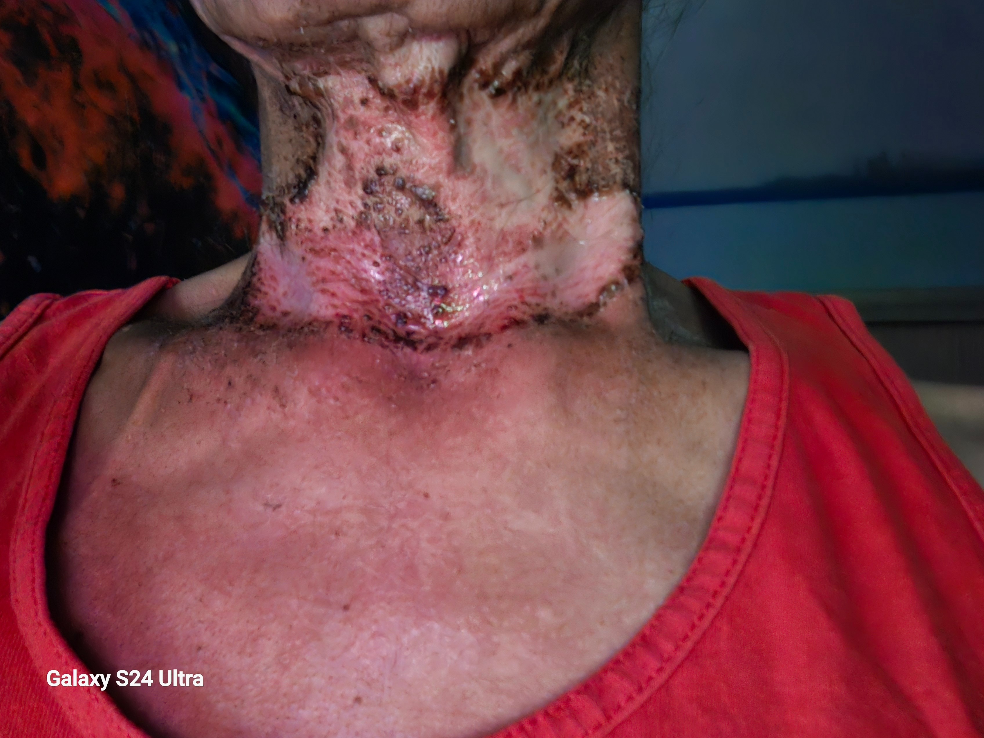 Help Ricky Jimmie Overcome Throat Cancer campaign photo, 7 of 8