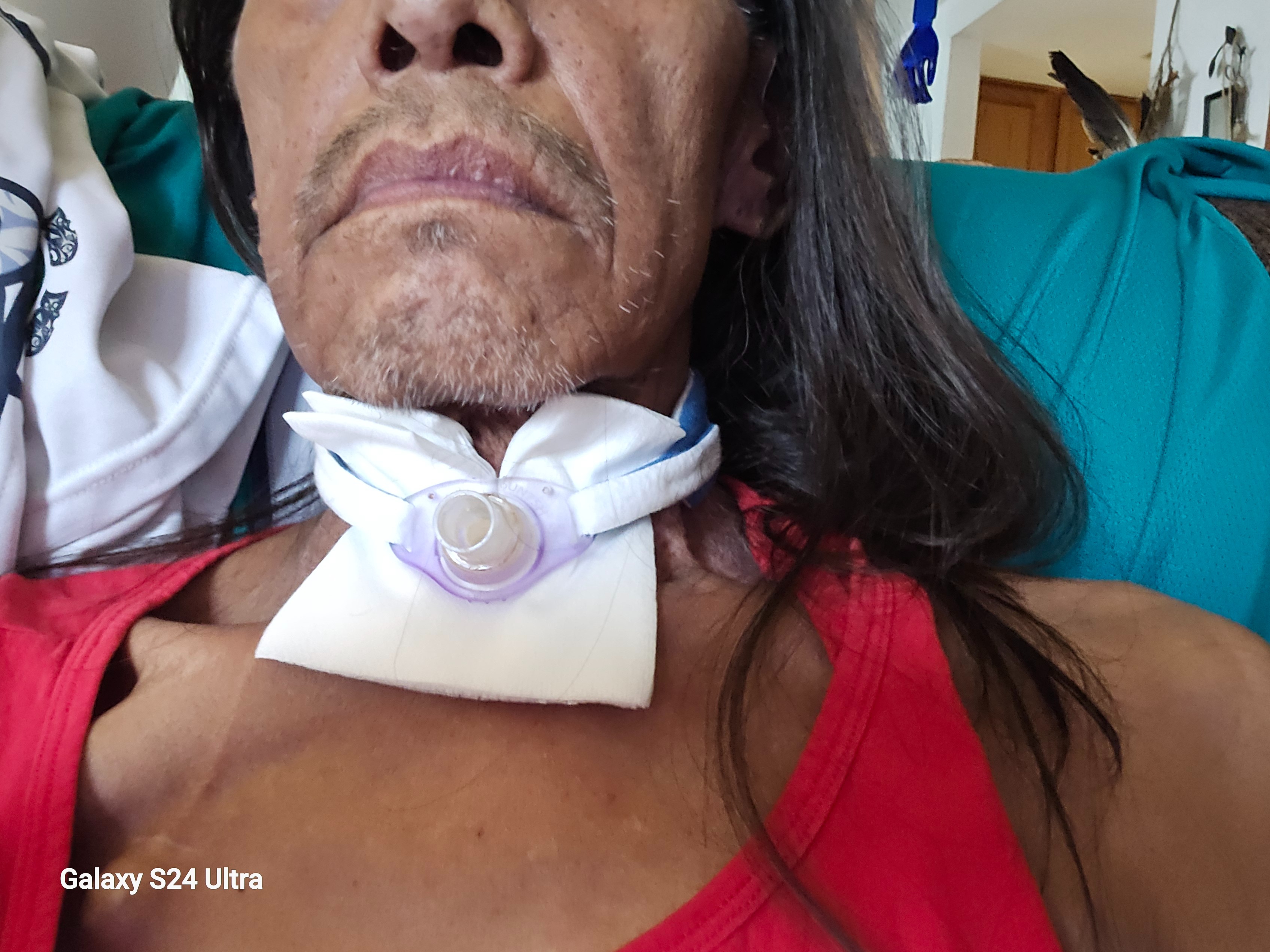 Help Ricky Jimmie Overcome Throat Cancer campaign photo, 2 of 8