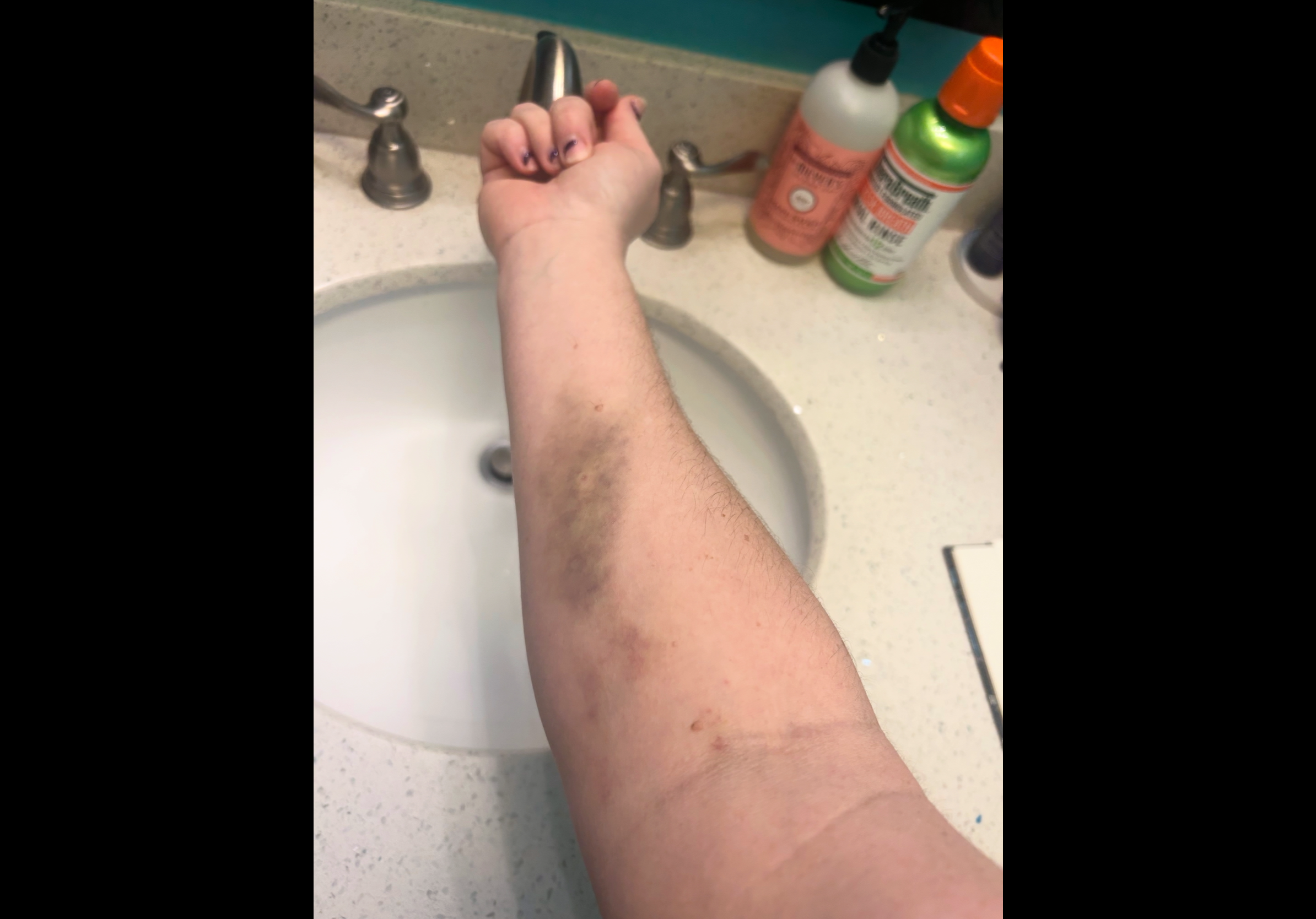Help Karelle Recover After a Life-Threatening Medical Crisis campaign photo, 5 of 7