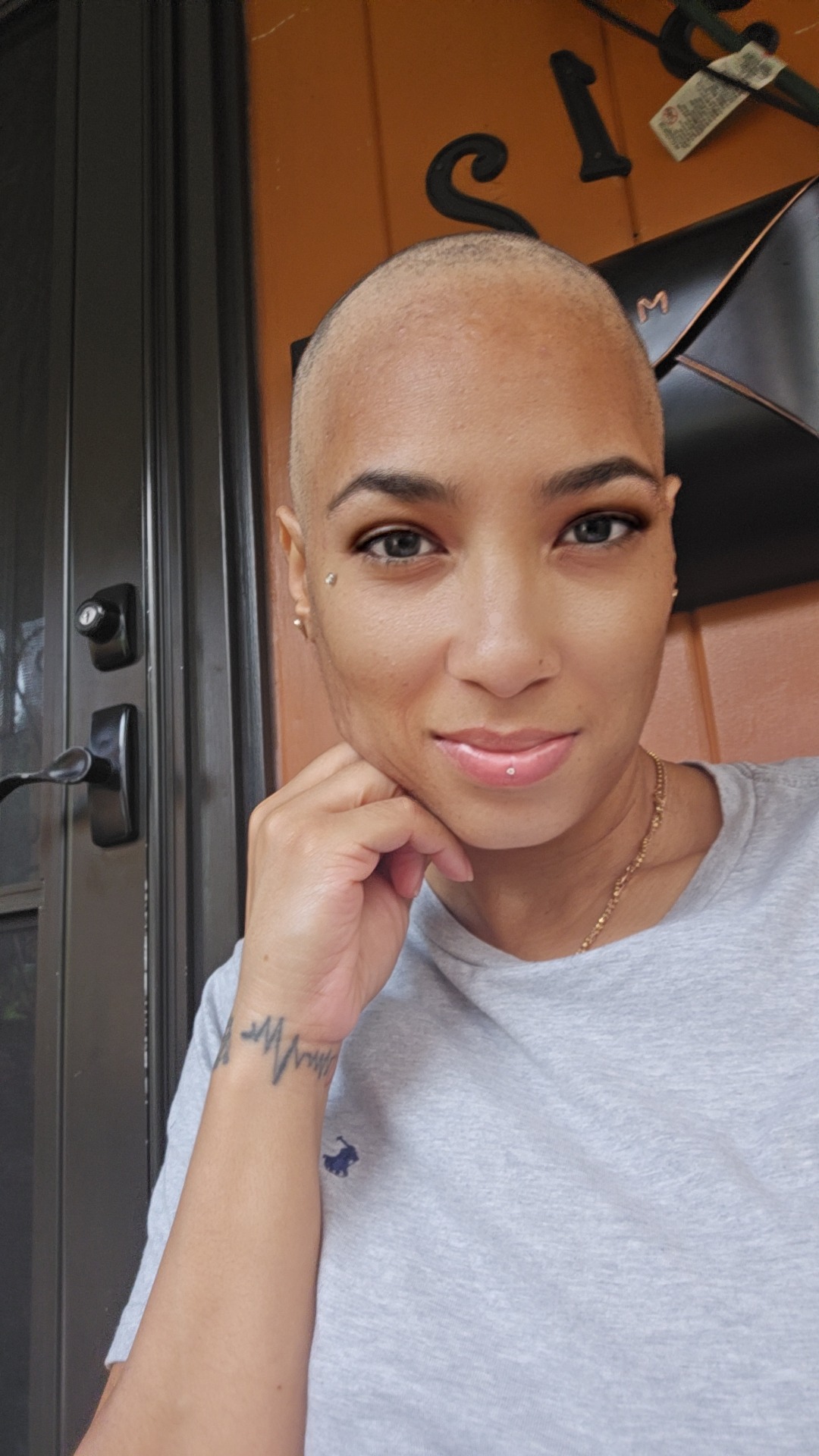 Join Lauren's battle against cancer - Your Support Matters campaign photo, 4 of 5