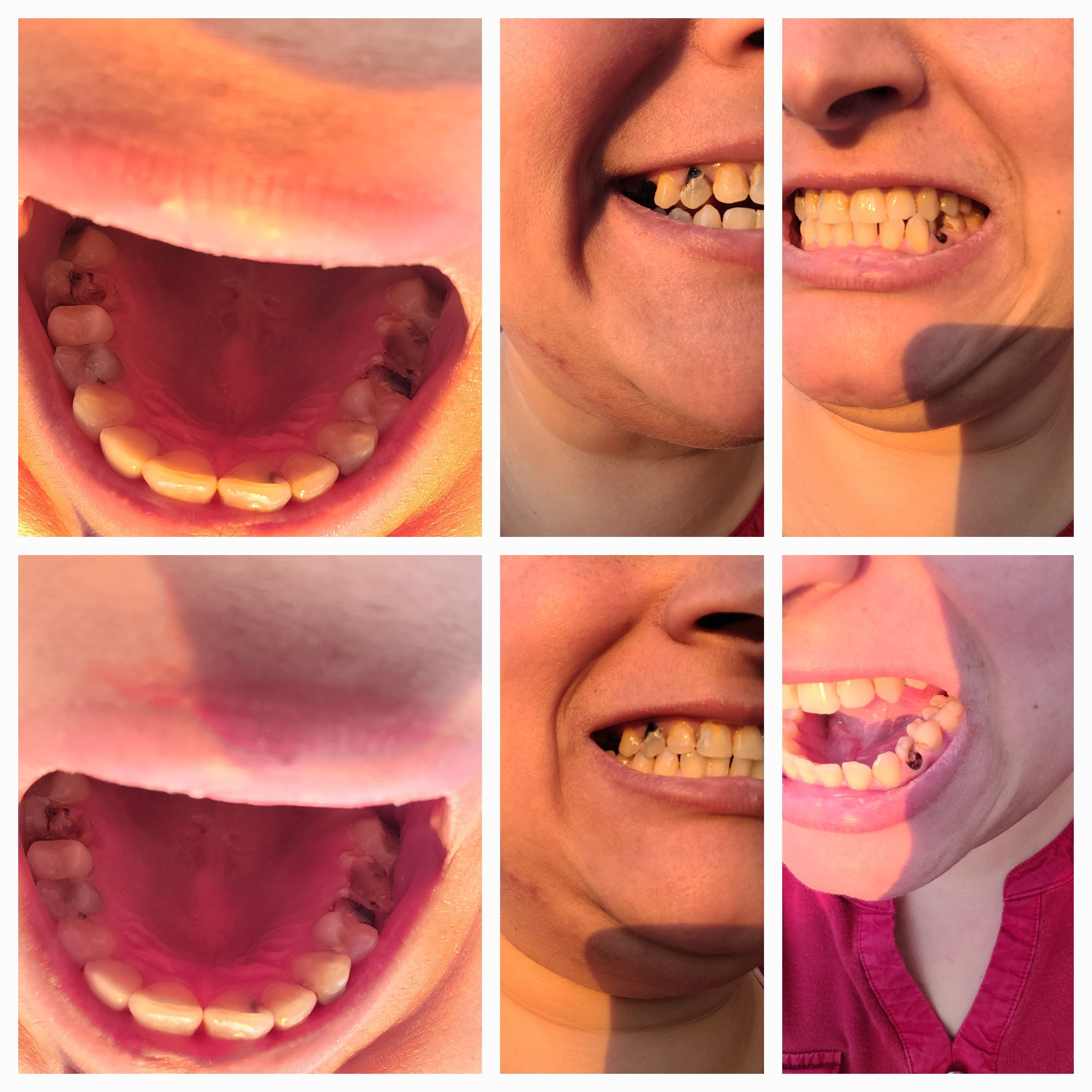 Urgent Dental Care for Julia campaign photo, 2 of 5