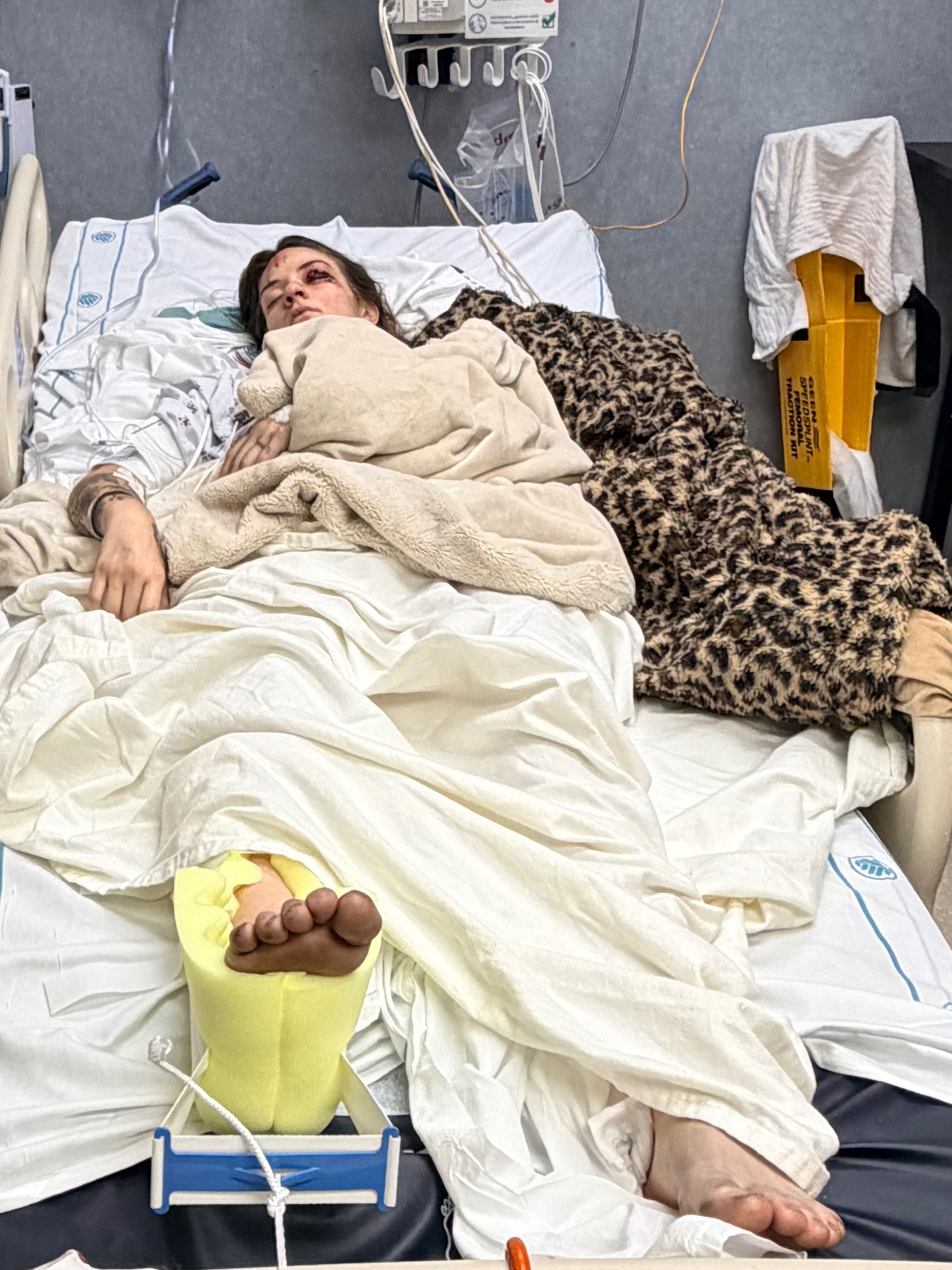 Donate to Aid in Greysan's Medical and Recovery Expenses campaign photo, 5 of 8