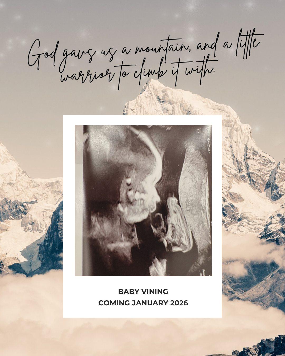 Support Baby Vining's CDH Journey campaign photo, 2 of 4