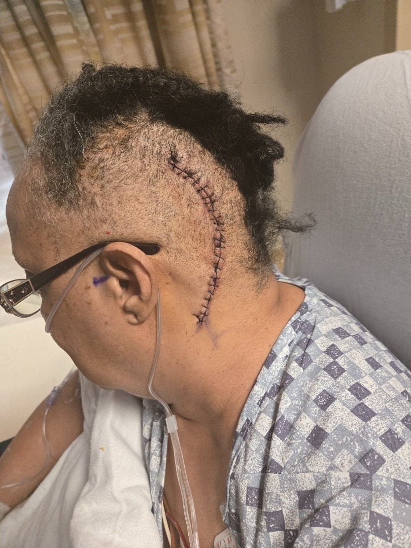 Helping Barbara on her recovery after brain surgery campaign photo, 2 of 5