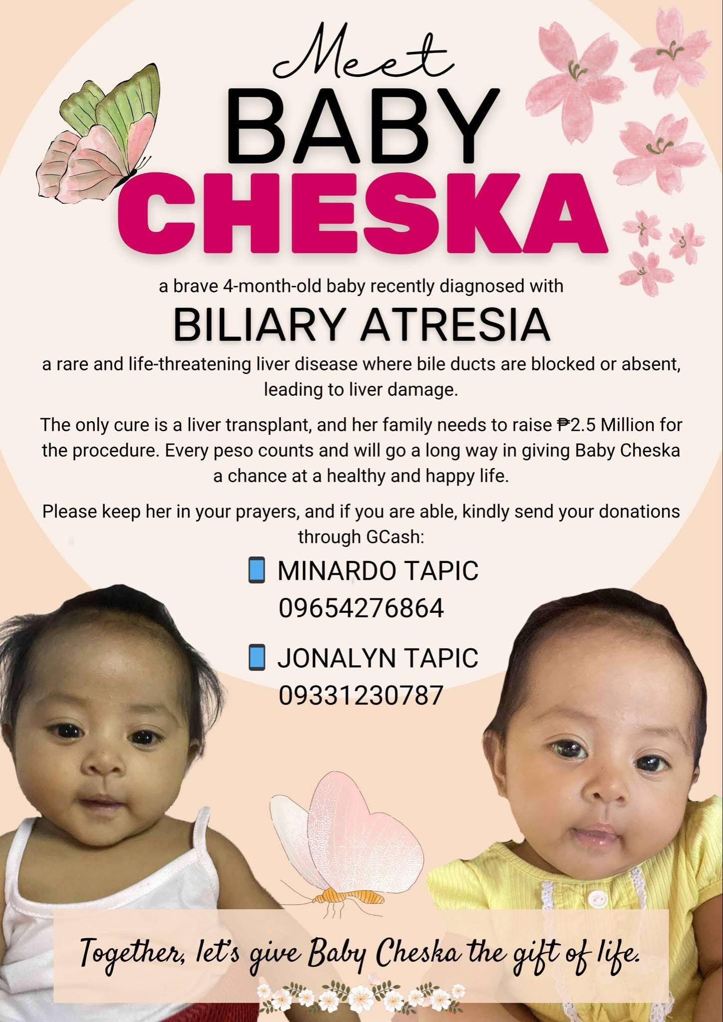 Help Baby Cheska Get a Life-Saving Liver Transplant campaign photo, 2 of 4