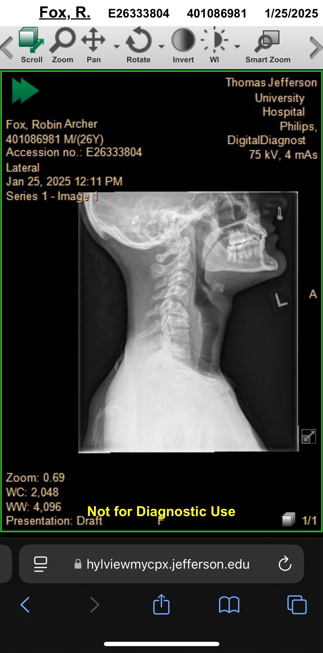 Help Robin Heal: Supporting Neck and Spine Surgery Recovery campaign photo, 5 of 6