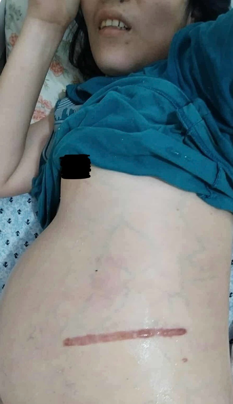 Support Mauren's Life-Saving Surgery campaign photo, 6 of 8