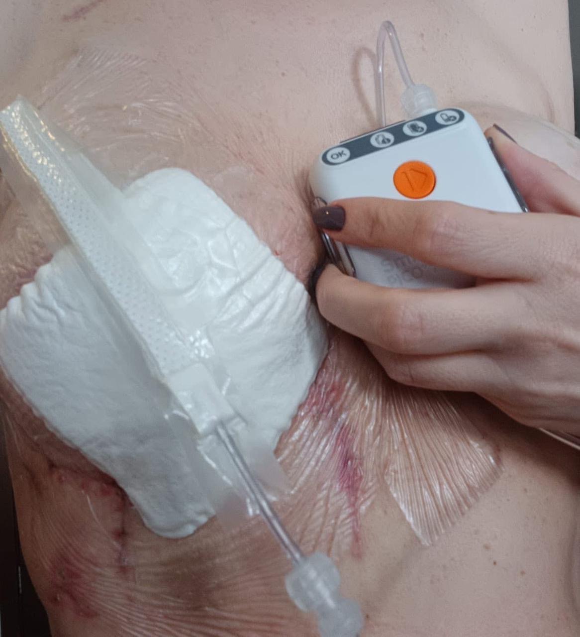 Aid Kátia's Breast Cancer Healing Journey in Brazil campaign photo, 4 of 7