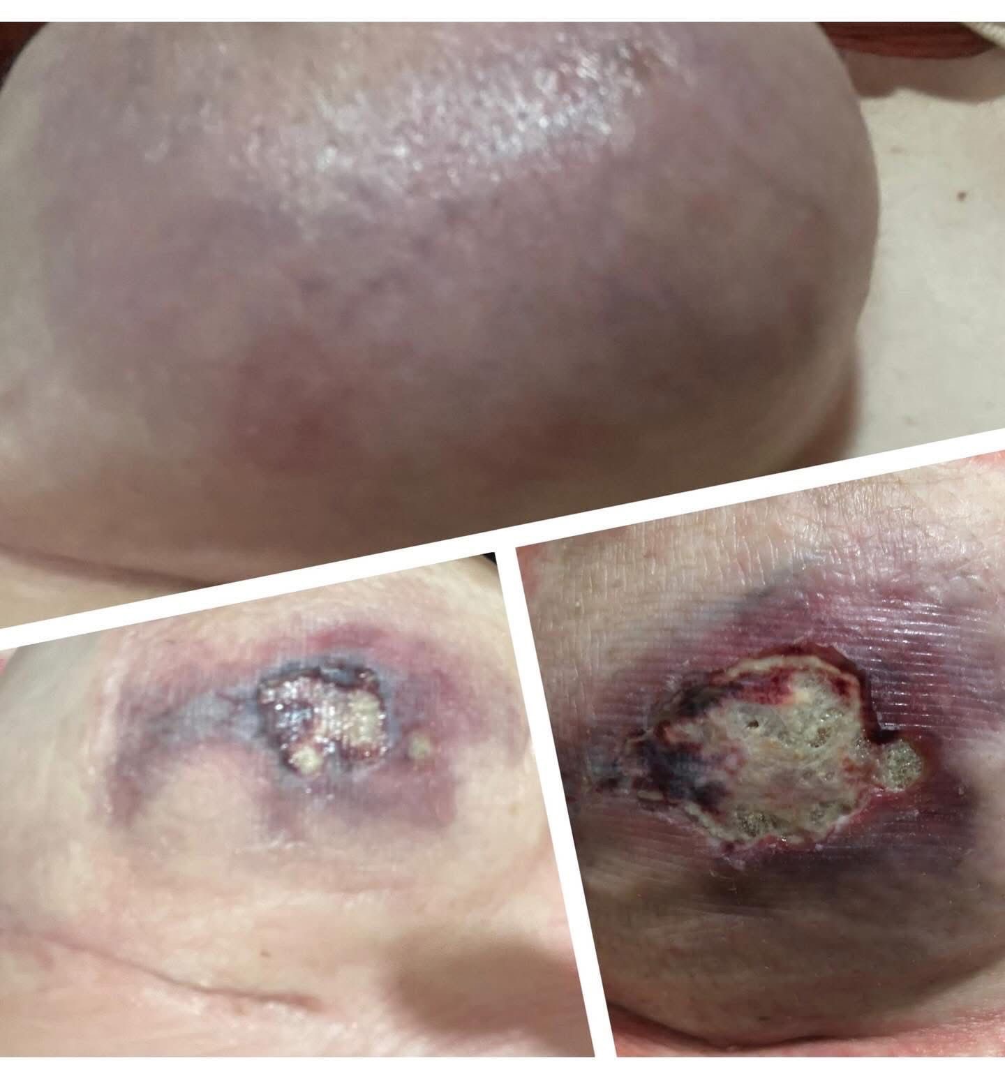 Aid Kátia's Breast Cancer Healing Journey in Brazil campaign photo, 2 of 7