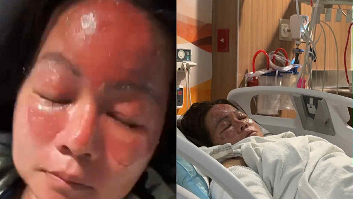 Fundraiser for Bishnu Rai by Padam Powdyel : Help the Rai Family ...