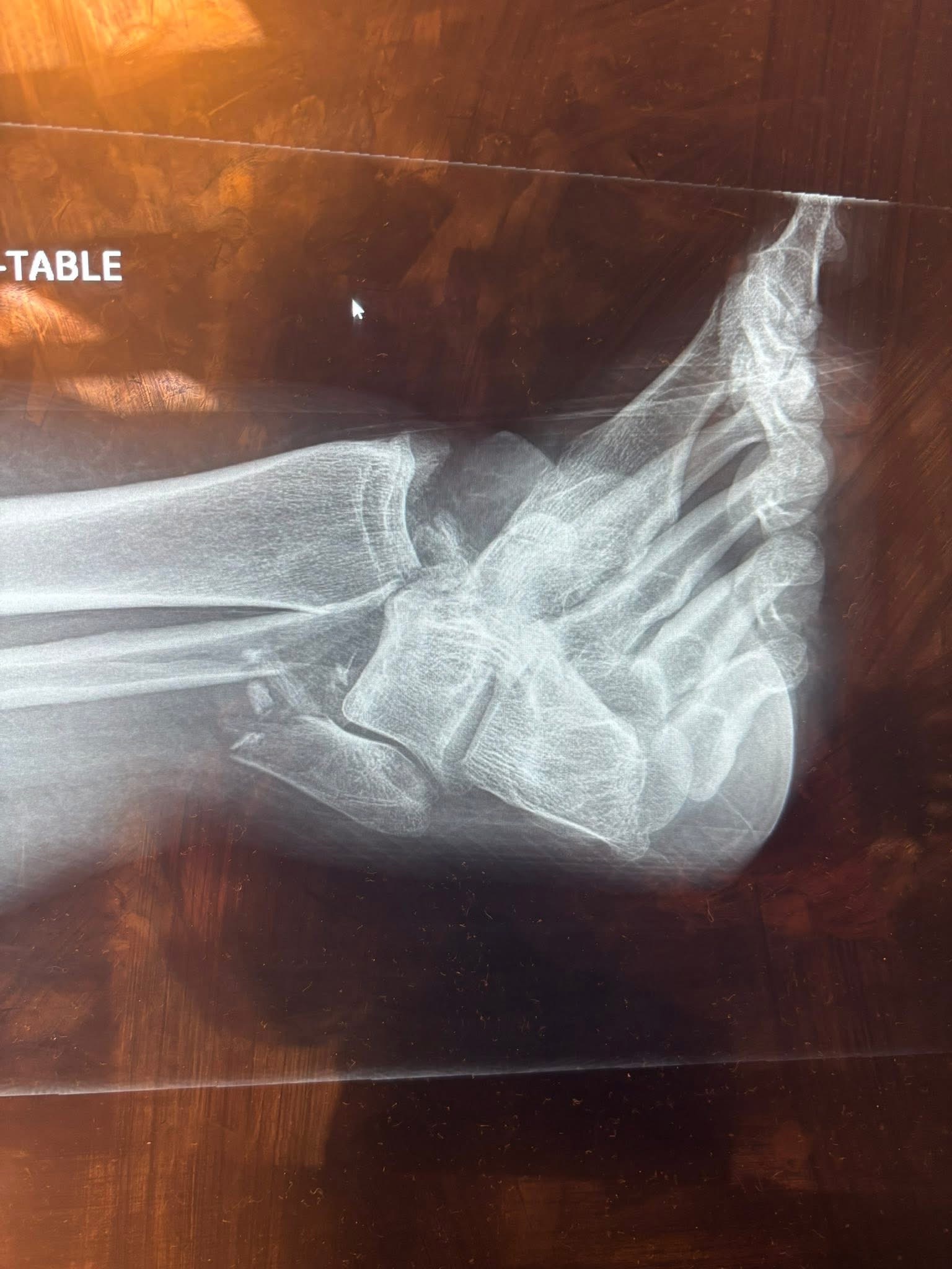 Help Keila Adkins Recover and Support Her Family campaign photo, 2 of 6