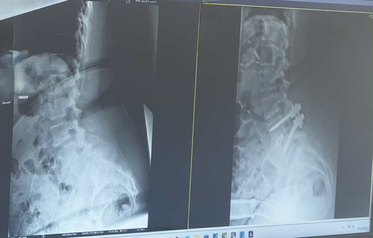 Help Kim Get Back on Her Feet After Emergency Spinal Surgery campaign photo, 6 of 7