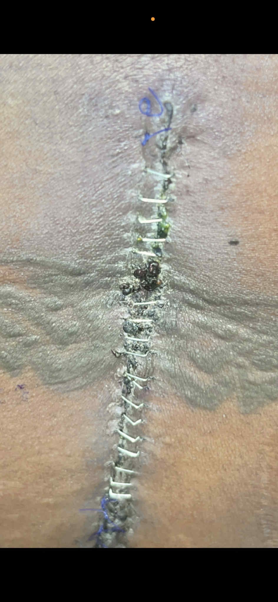 Help Kim Get Back on Her Feet After Emergency Spinal Surgery campaign photo, 4 of 7