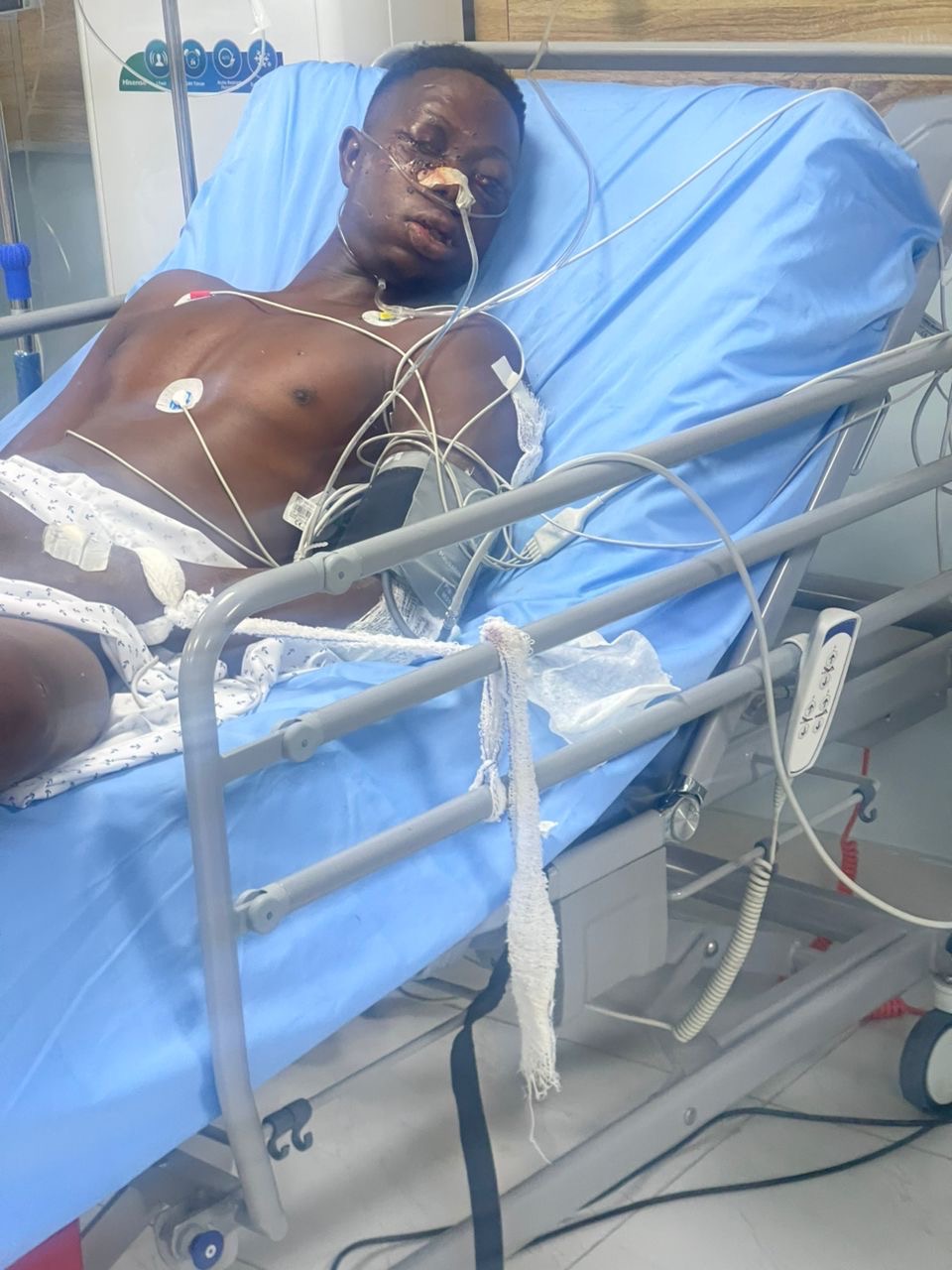 Help Save Diekololaoluwa’s Life After a Brutal Attack campaign photo, 2 of 7