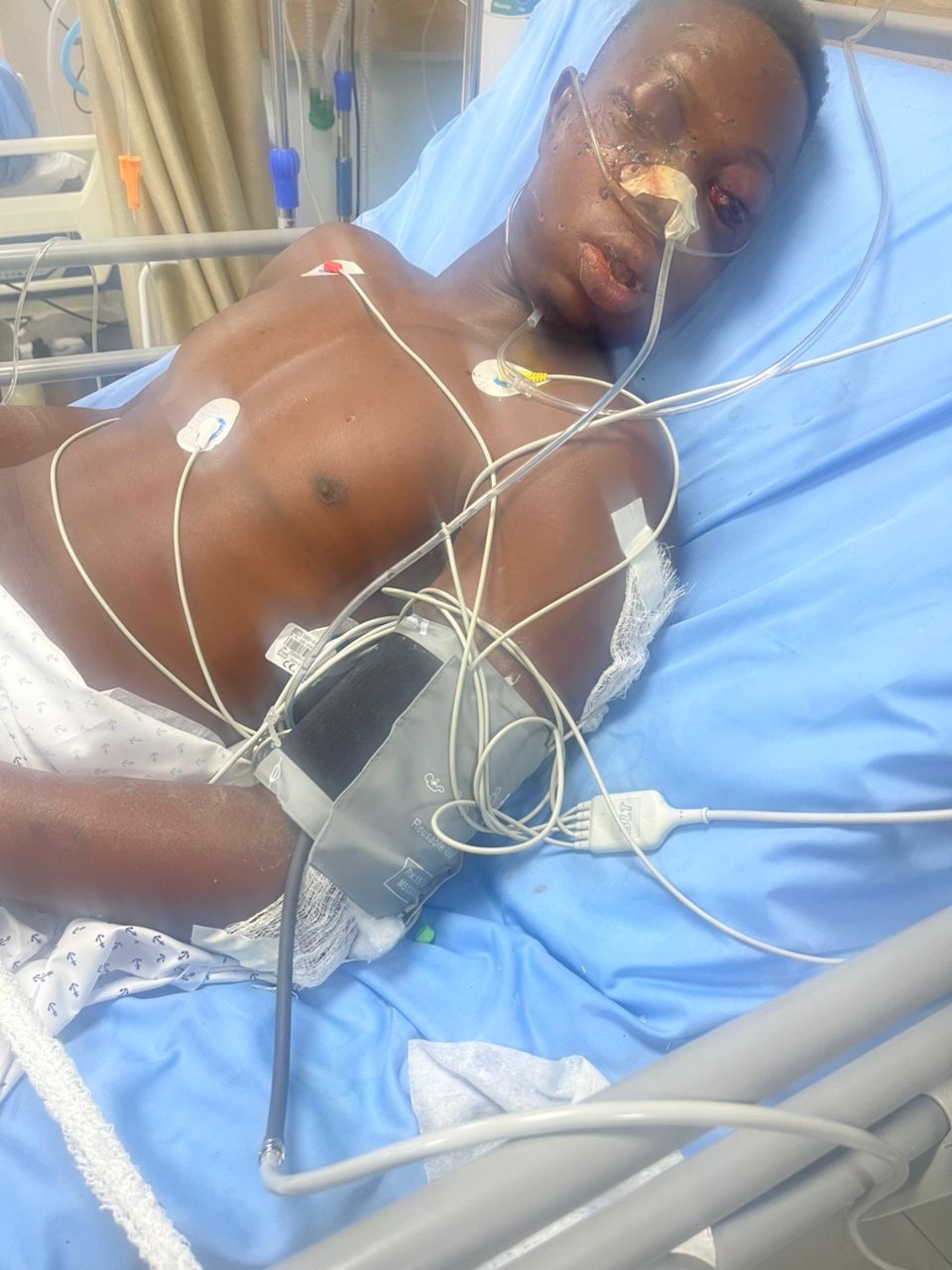Help Save Diekololaoluwa’s Life After a Brutal Attack campaign photo, 5 of 7