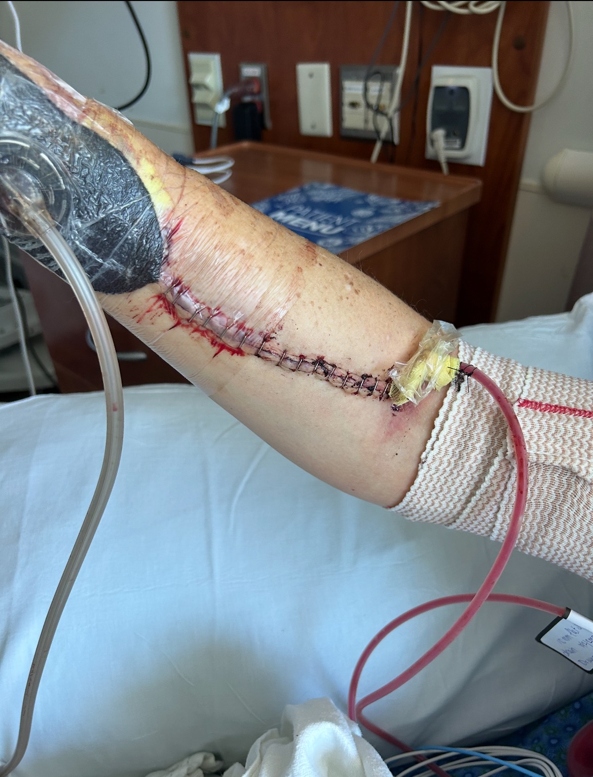 Healing one step at a time:  Supporting Amber’s Journey campaign photo, 2 of 5