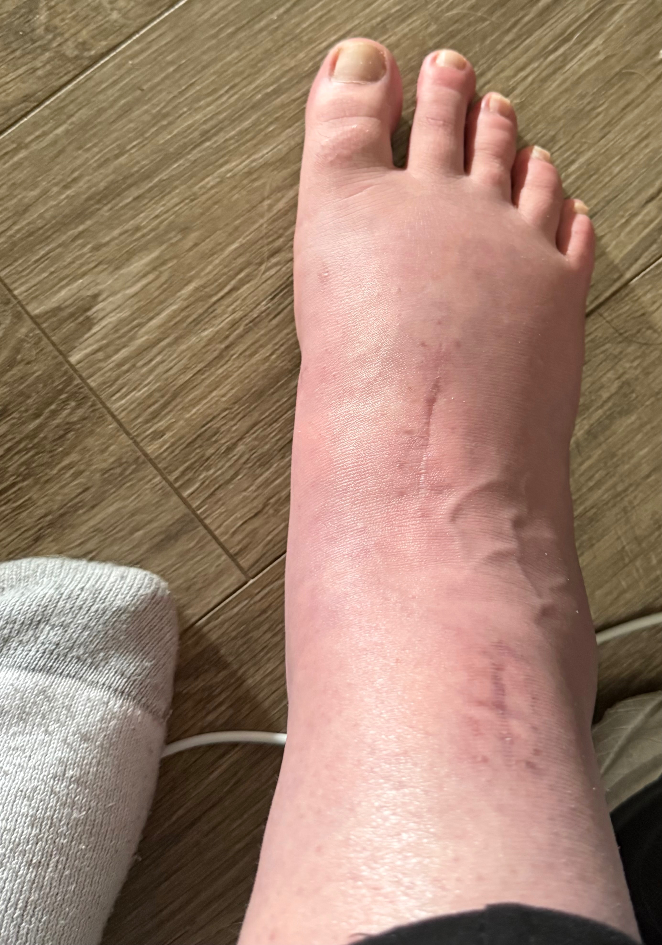 Donate as Emily and Zachary Battle Ongoing Medical Struggles campaign photo, 4 of 7