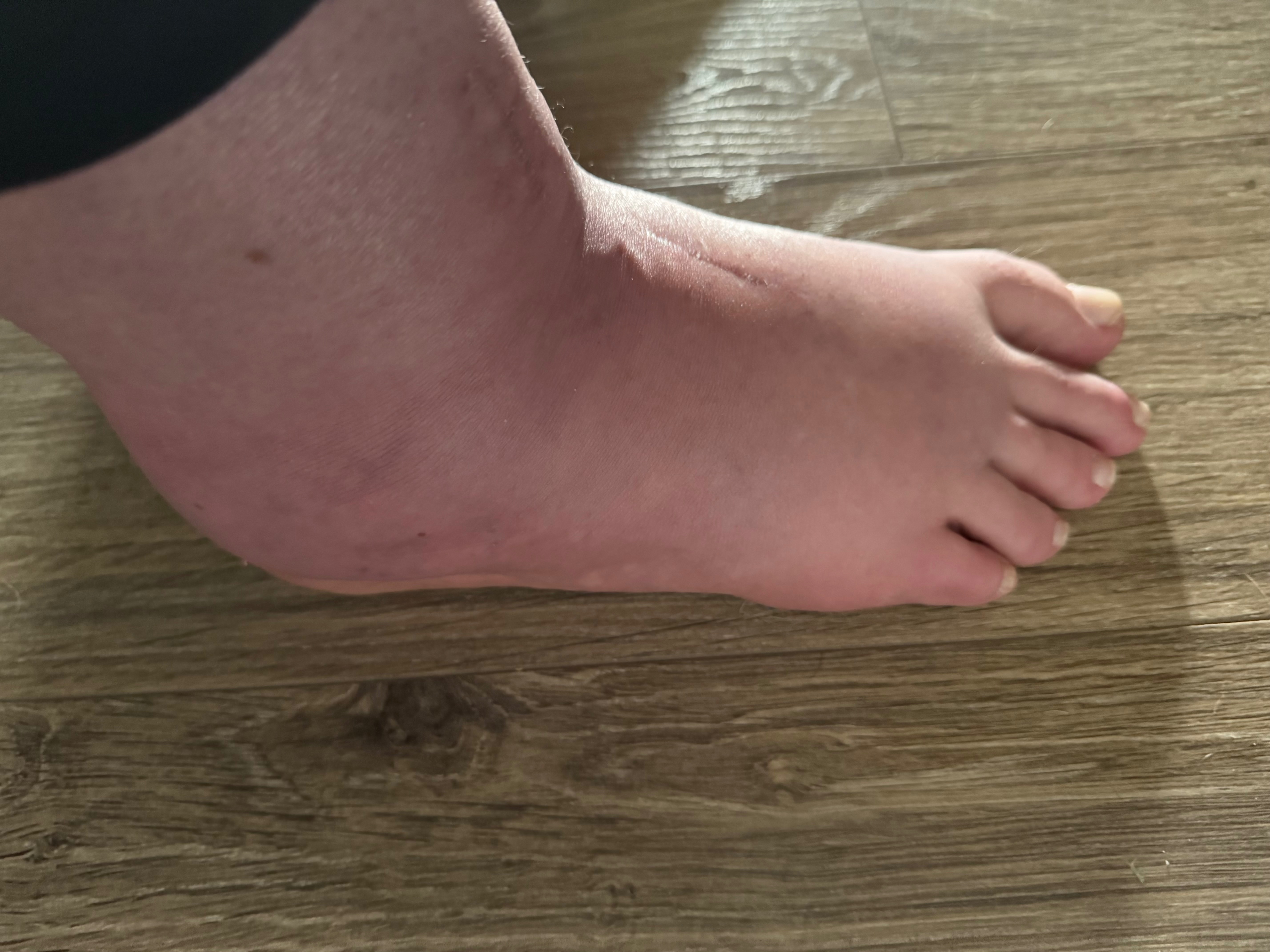 Donate as Emily and Zachary Battle Ongoing Medical Struggles campaign photo, 5 of 7