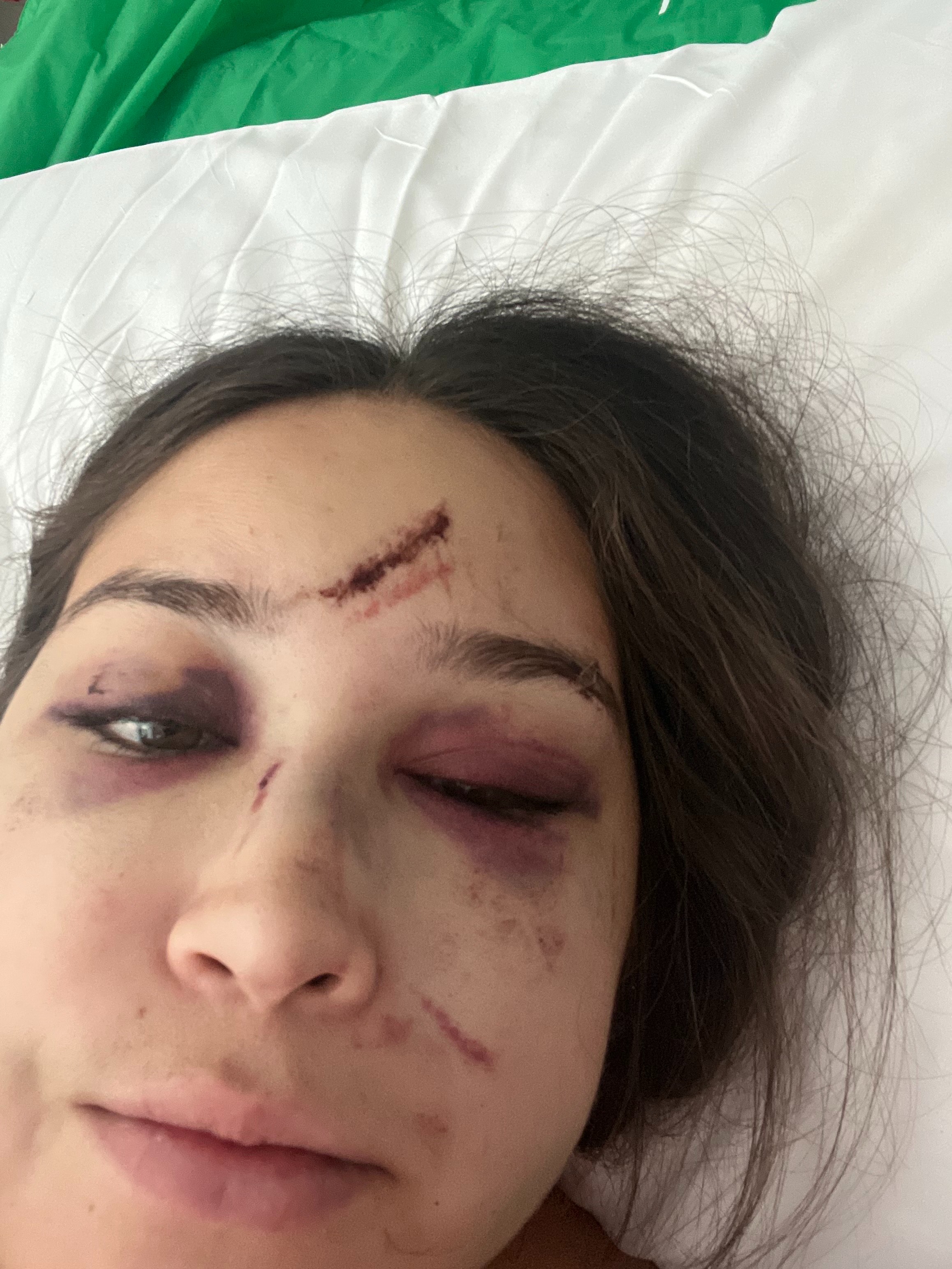 Aid Carmen Bastidas' Healing Journey campaign photo, 5 of 8