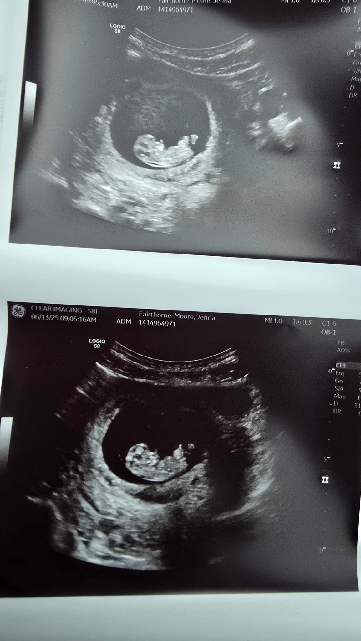 Baby Landon !!! campaign photo, 7 of 8