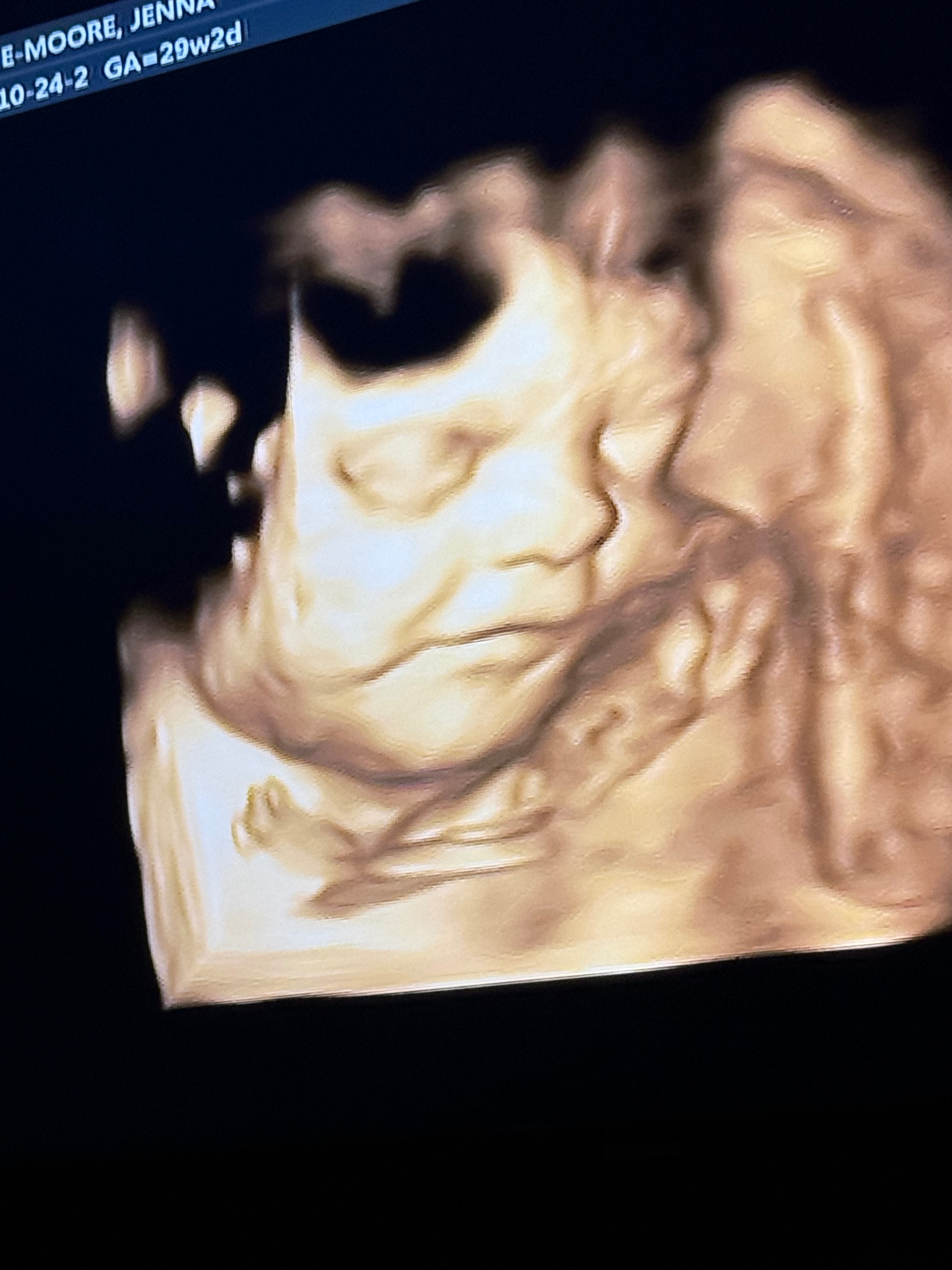 Baby Landon !!! campaign photo, 5 of 8