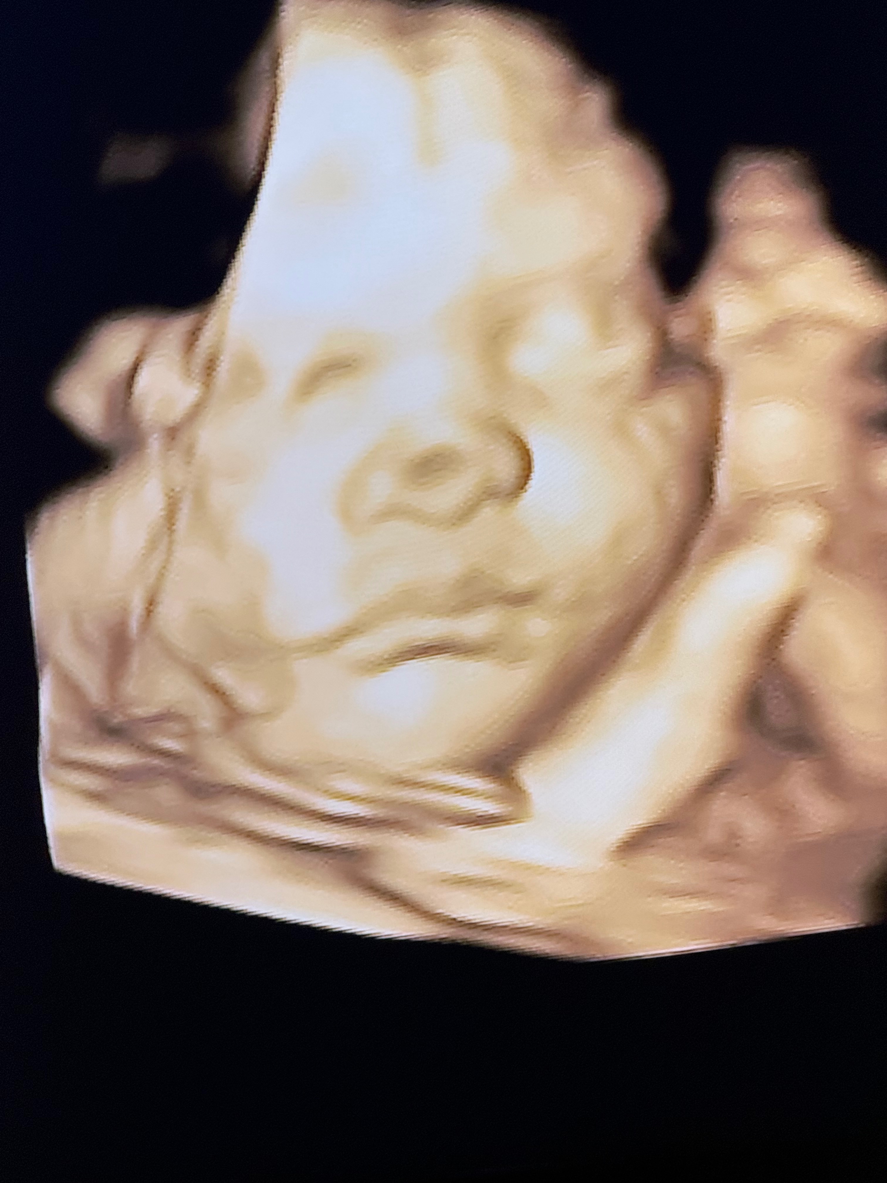 Baby Landon !!! campaign photo, 6 of 8