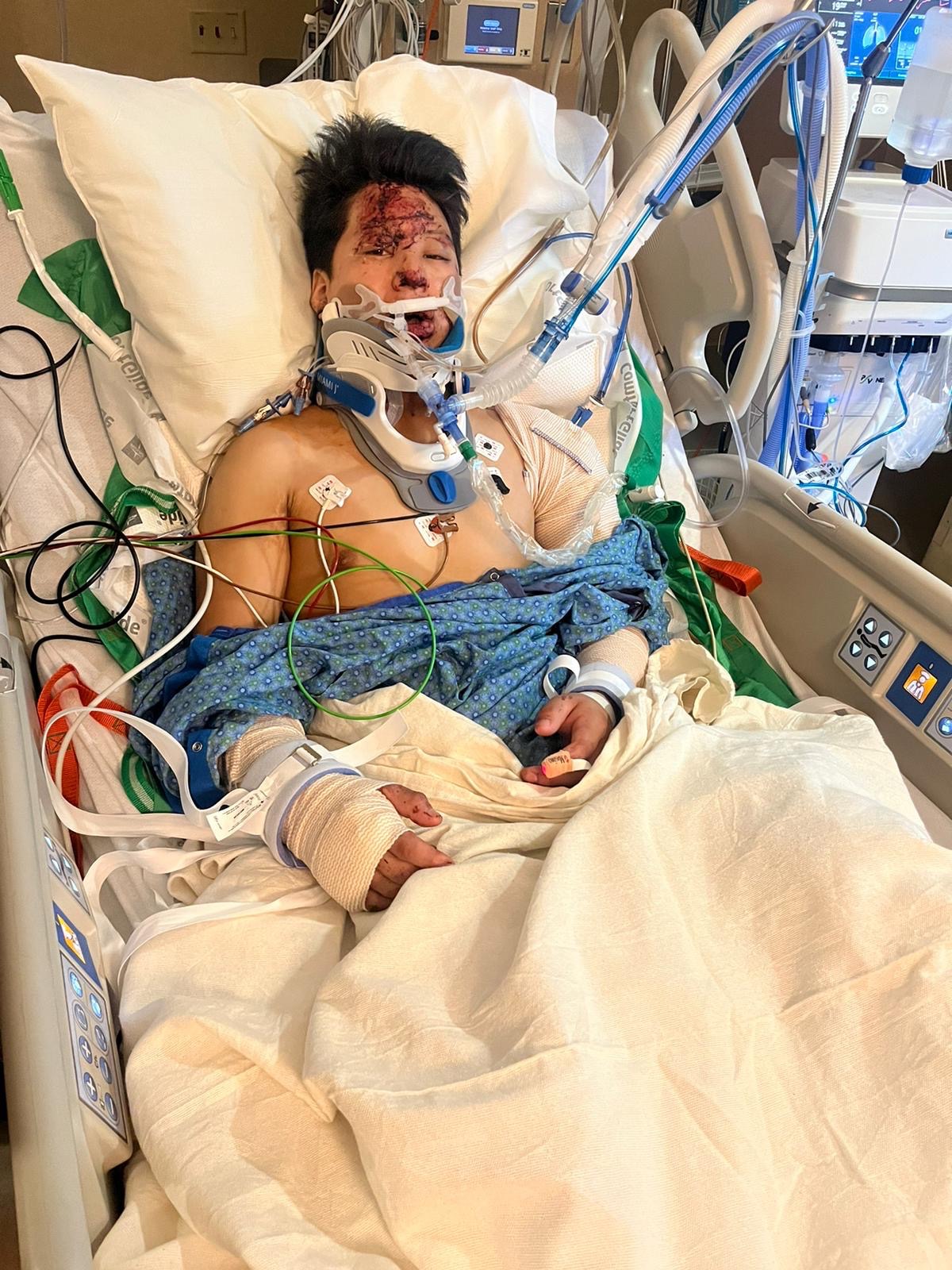 Support Dilson's Recovery After Accident campaign photo, 2 of 5