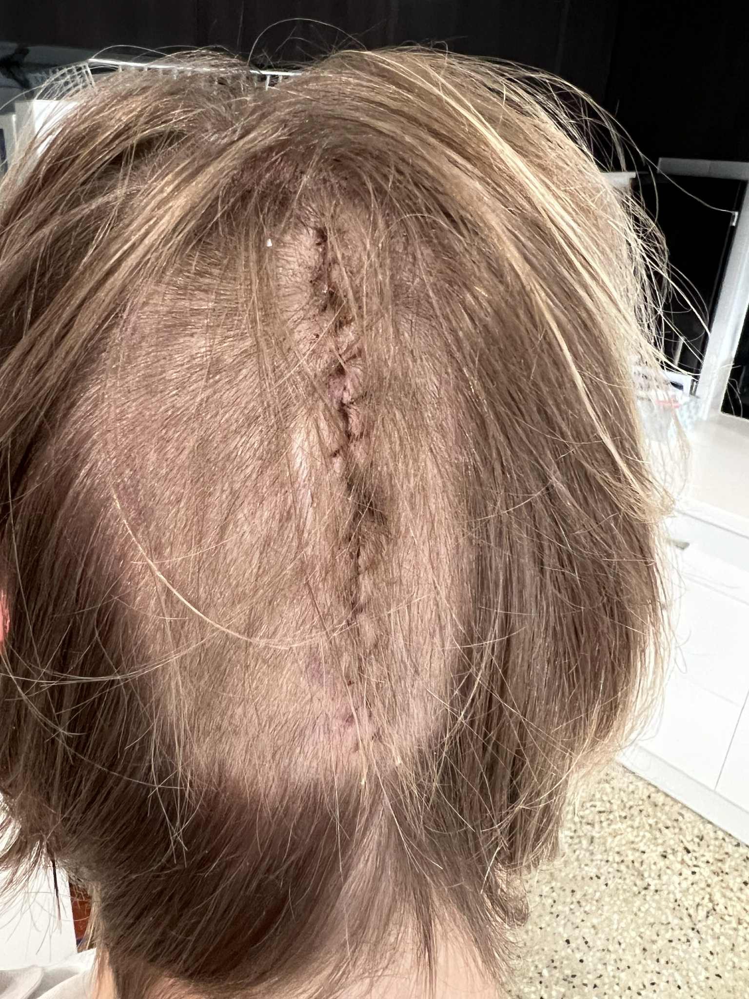 Help support Lisa’s brain surgery recovery campaign photo, 4 of 8