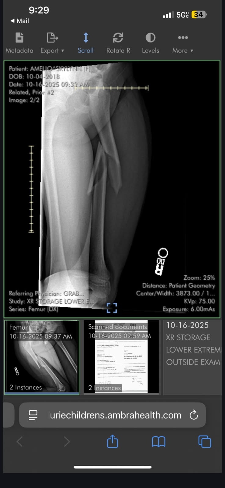 Aid Skylynn's Healing Process campaign photo, 2 of 8