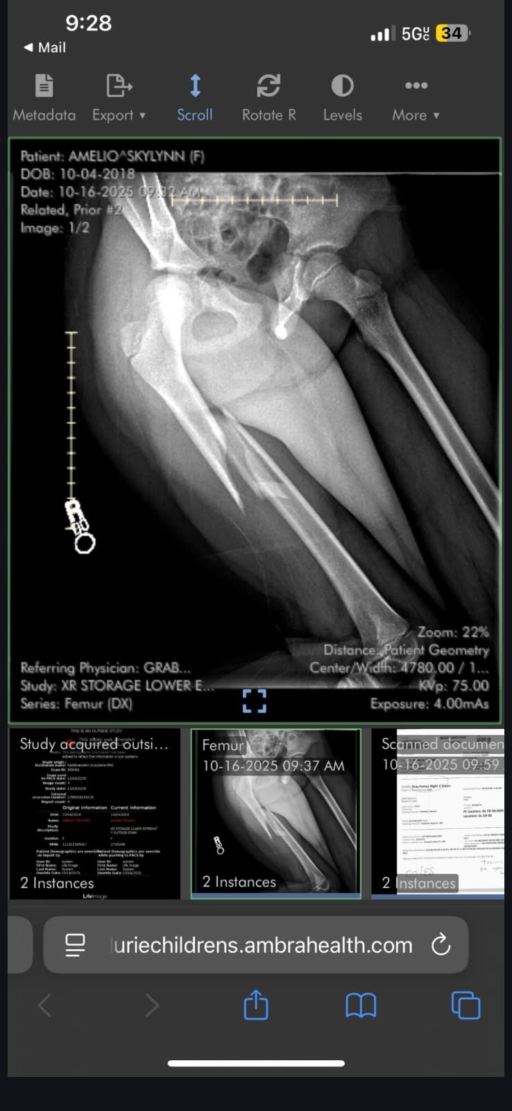 Aid Skylynn's Healing Process campaign photo, 4 of 8